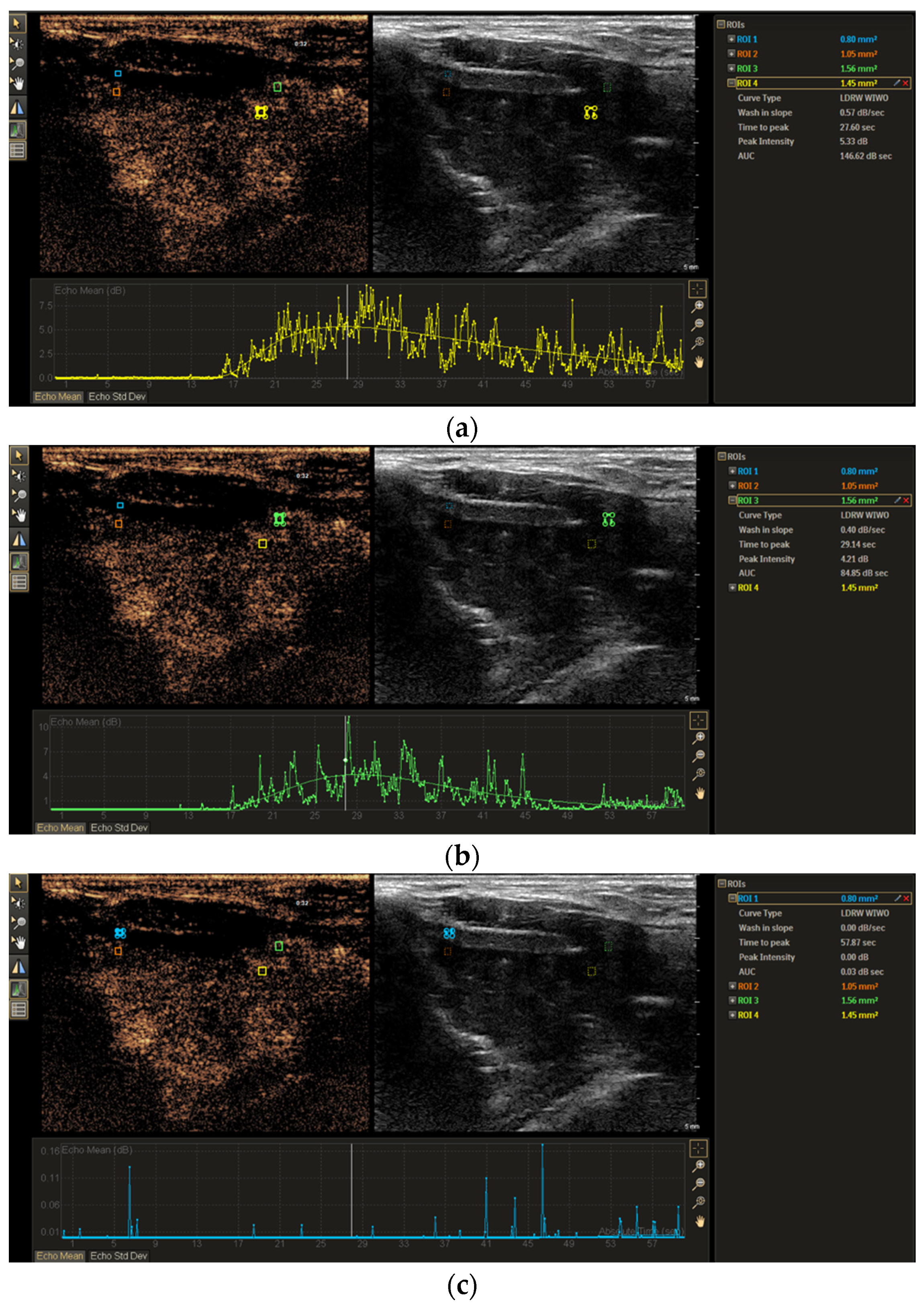 Tomography 11 00057 g003
