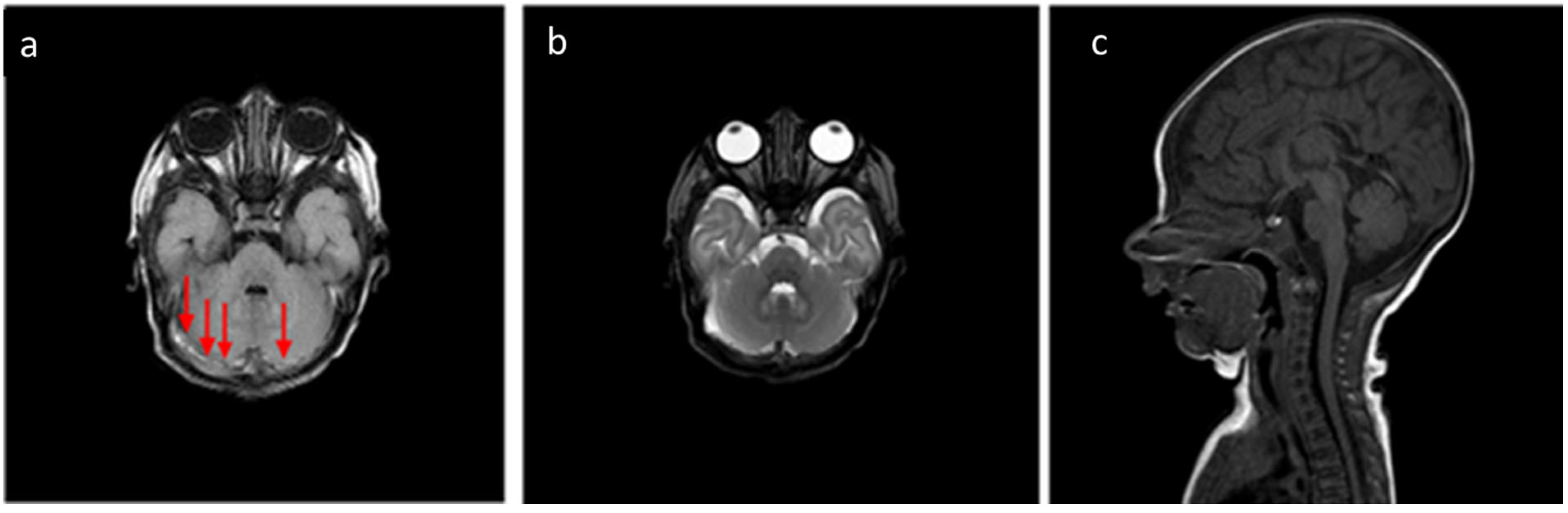 Tomography 11 00058 g003