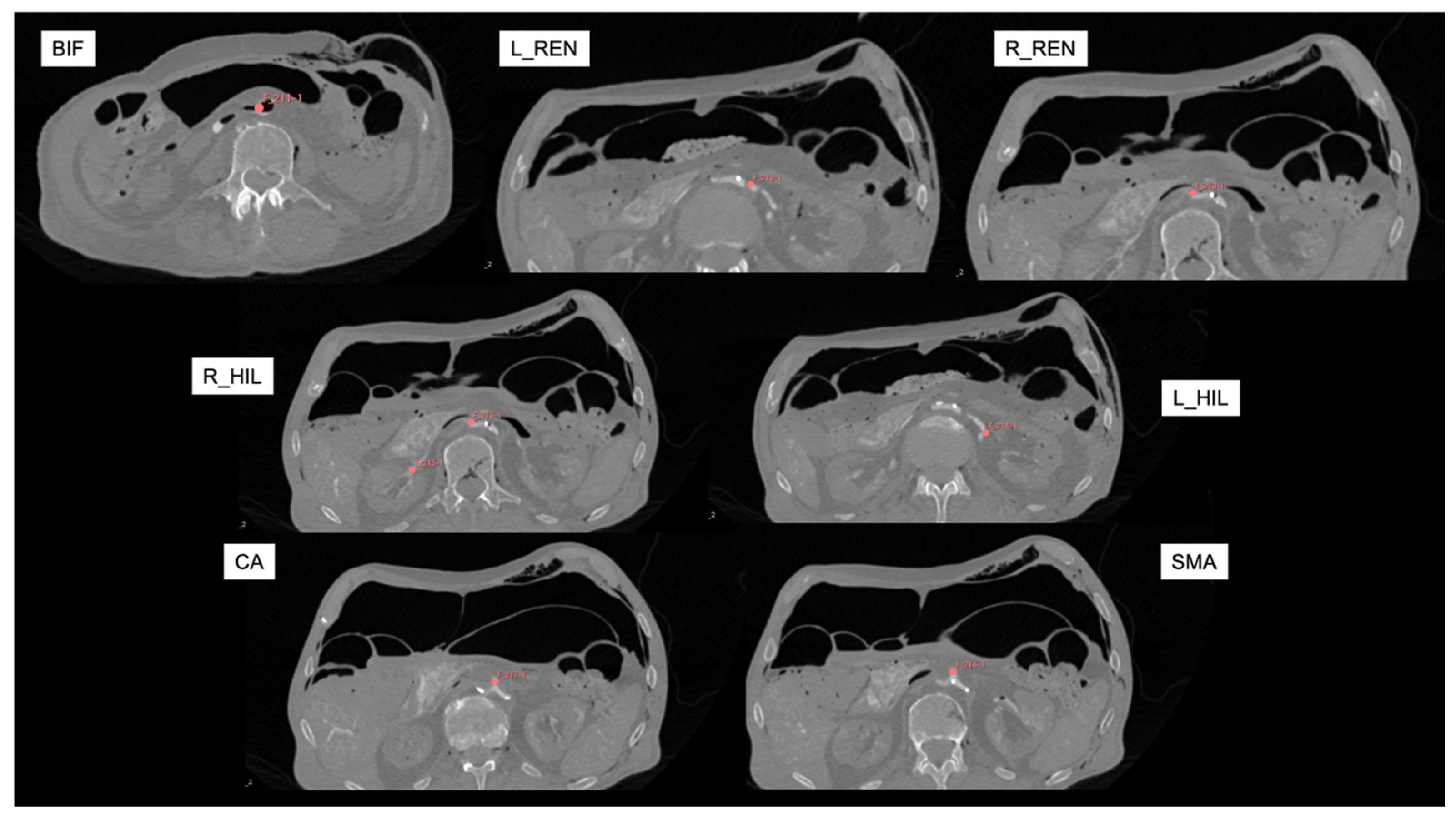 Tomography 11 00060 g002