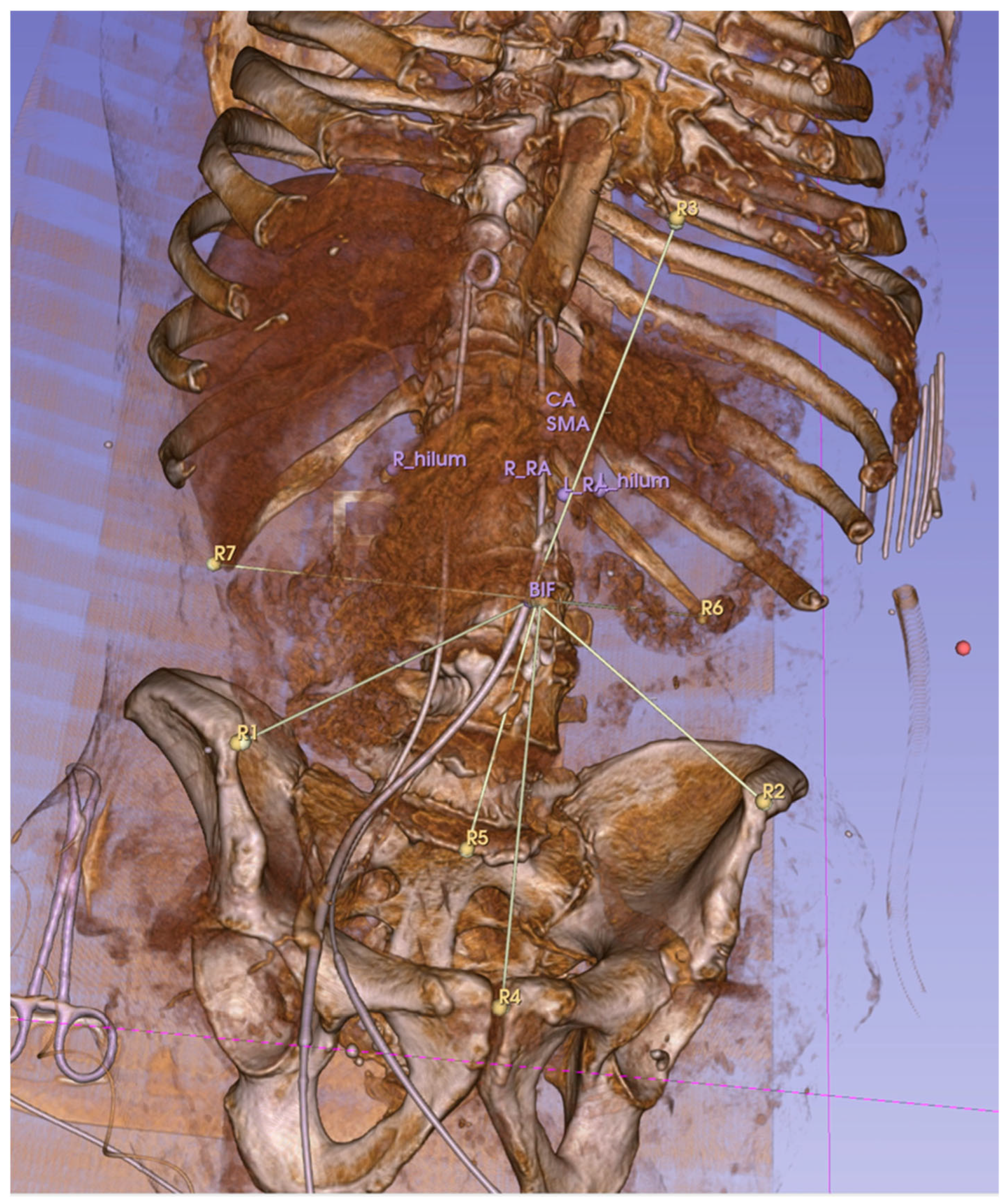 Tomography 11 00060 g003