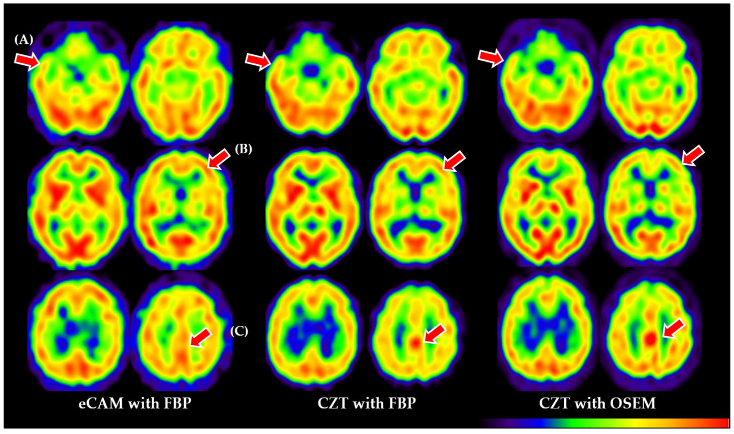 Tomography 11 00061 g001