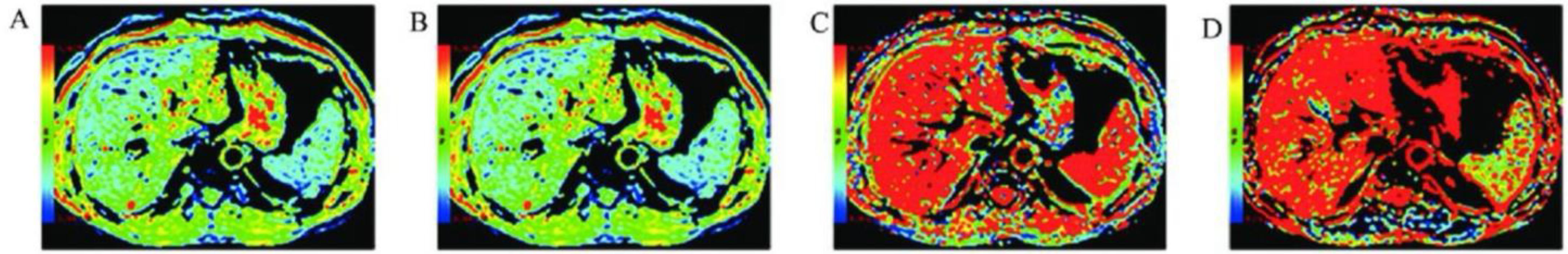 Tomography 11 00063 g002