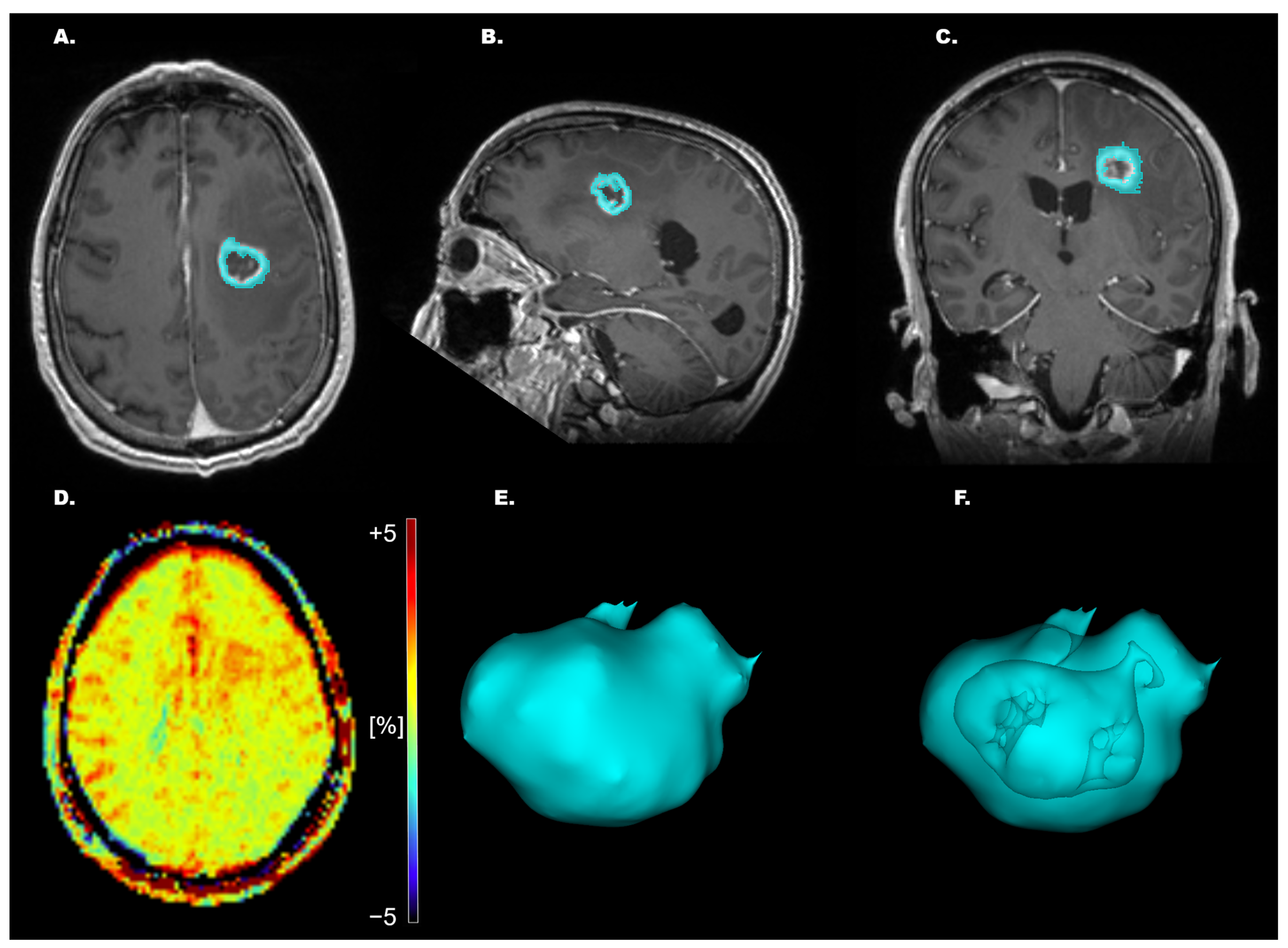 Tomography 11 00064 g001 Tomography 11 00064 g001