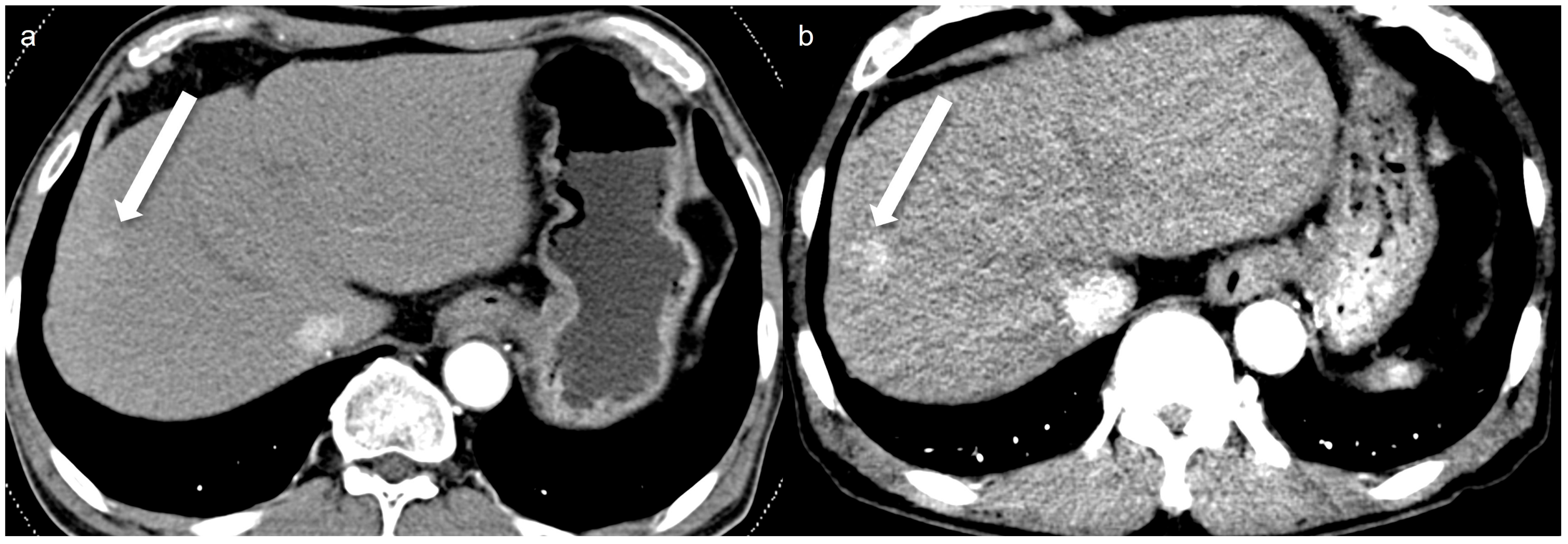 Tomography 11 00066 g003