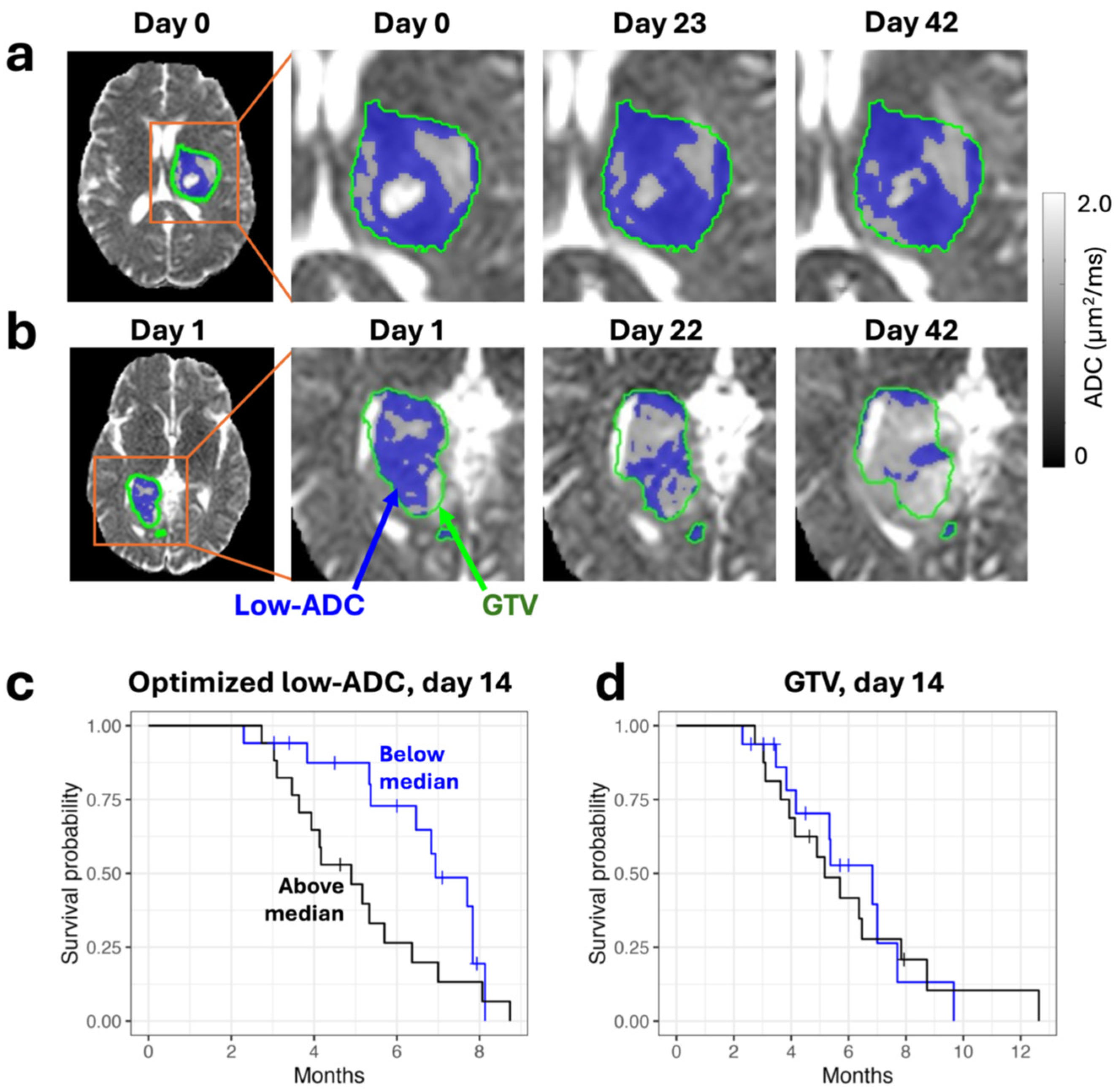 Tomography 11 00068 g003