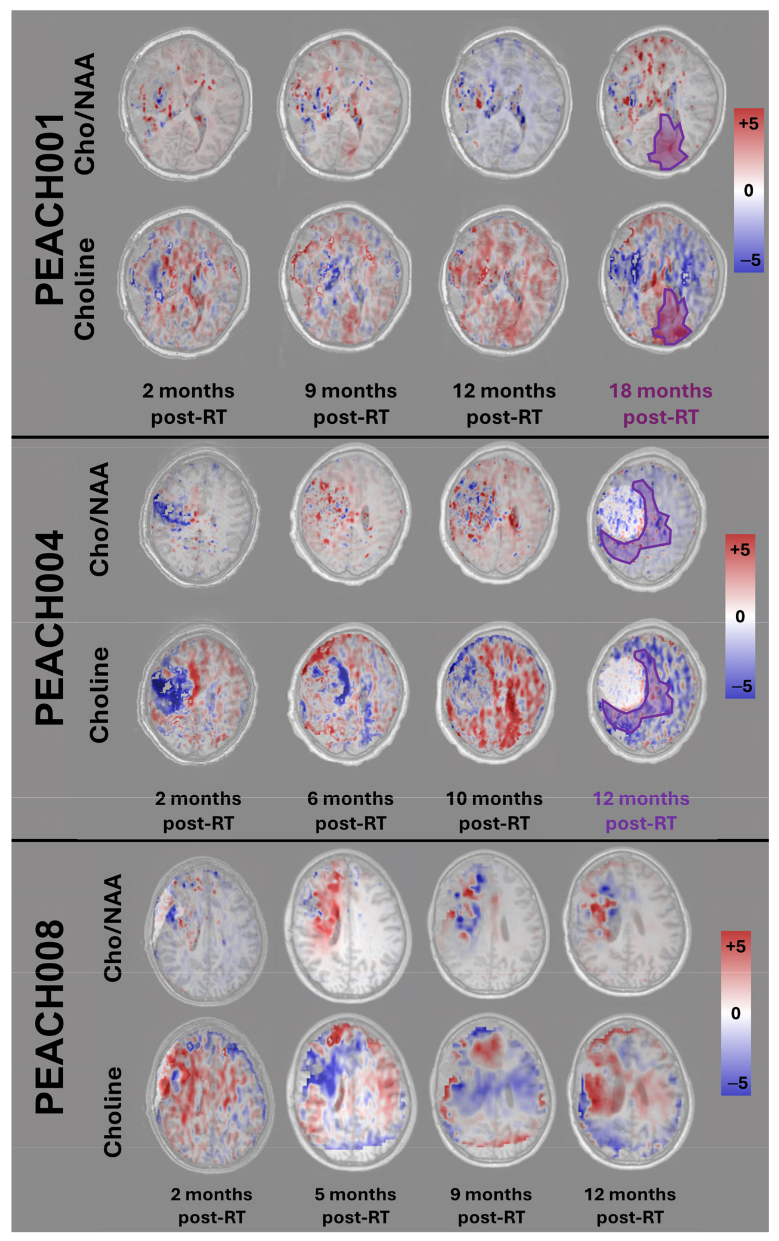 Tomography 11 00071 g005