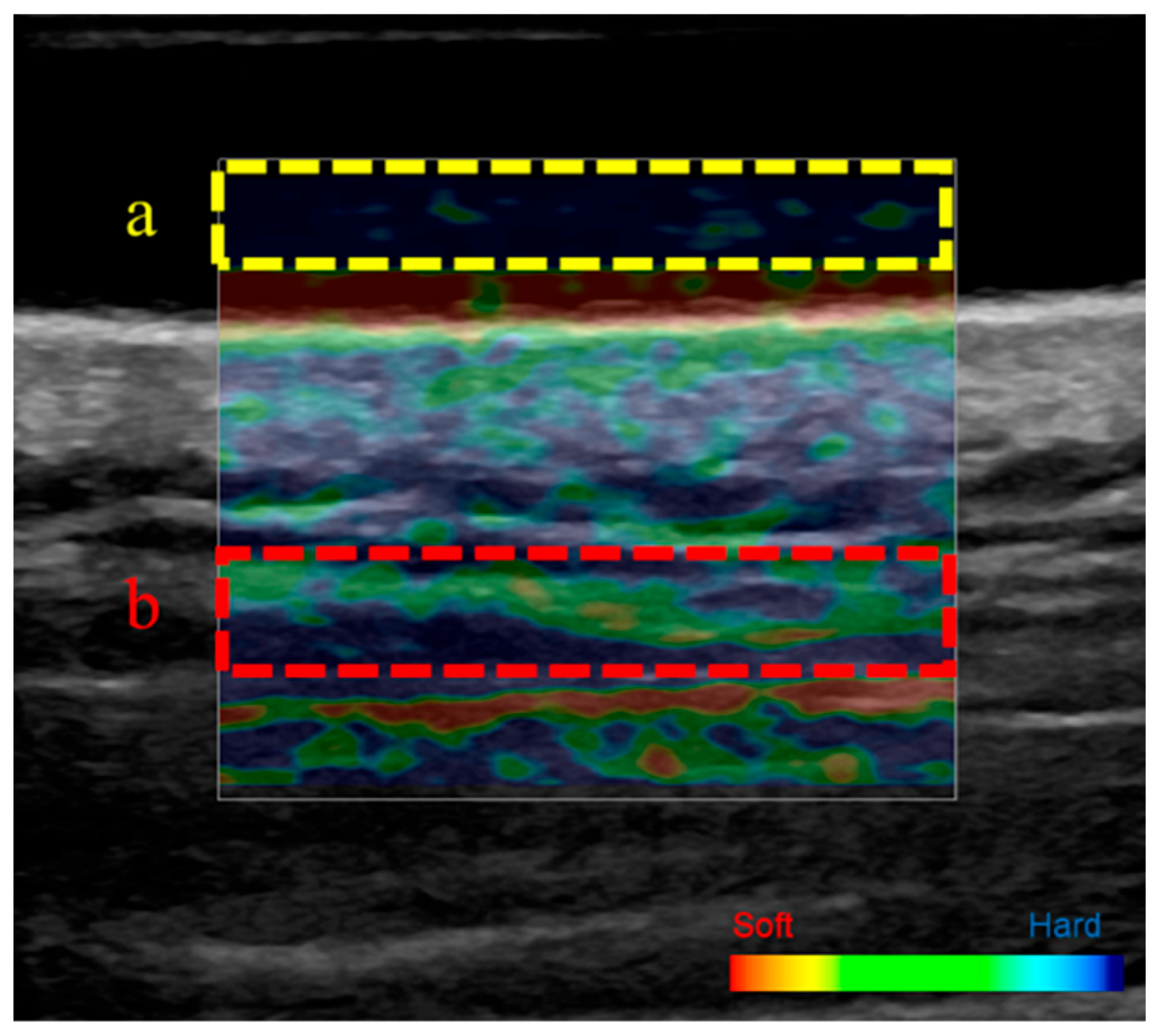 Tomography 11 00073 g002