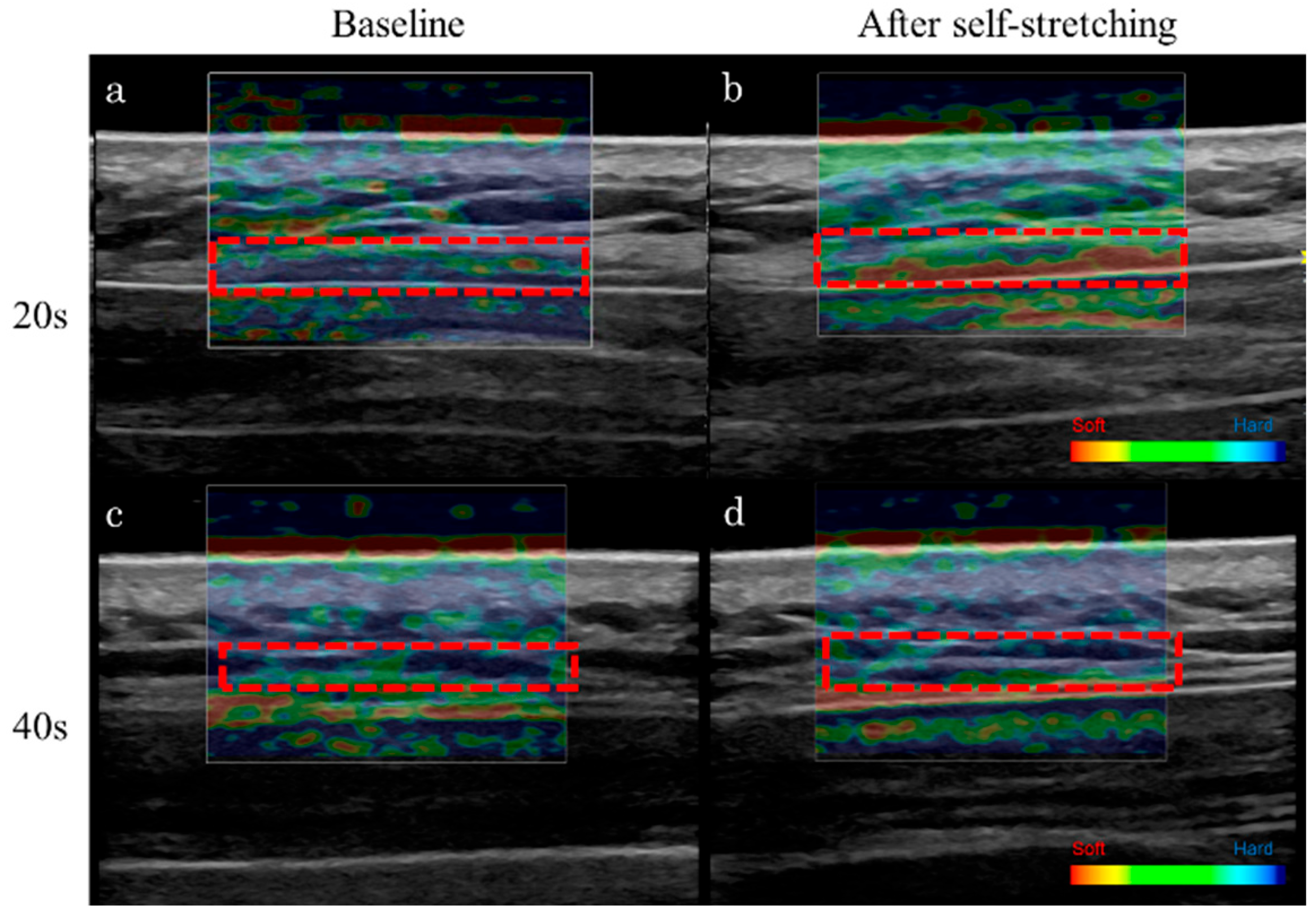 Tomography 11 00073 g003