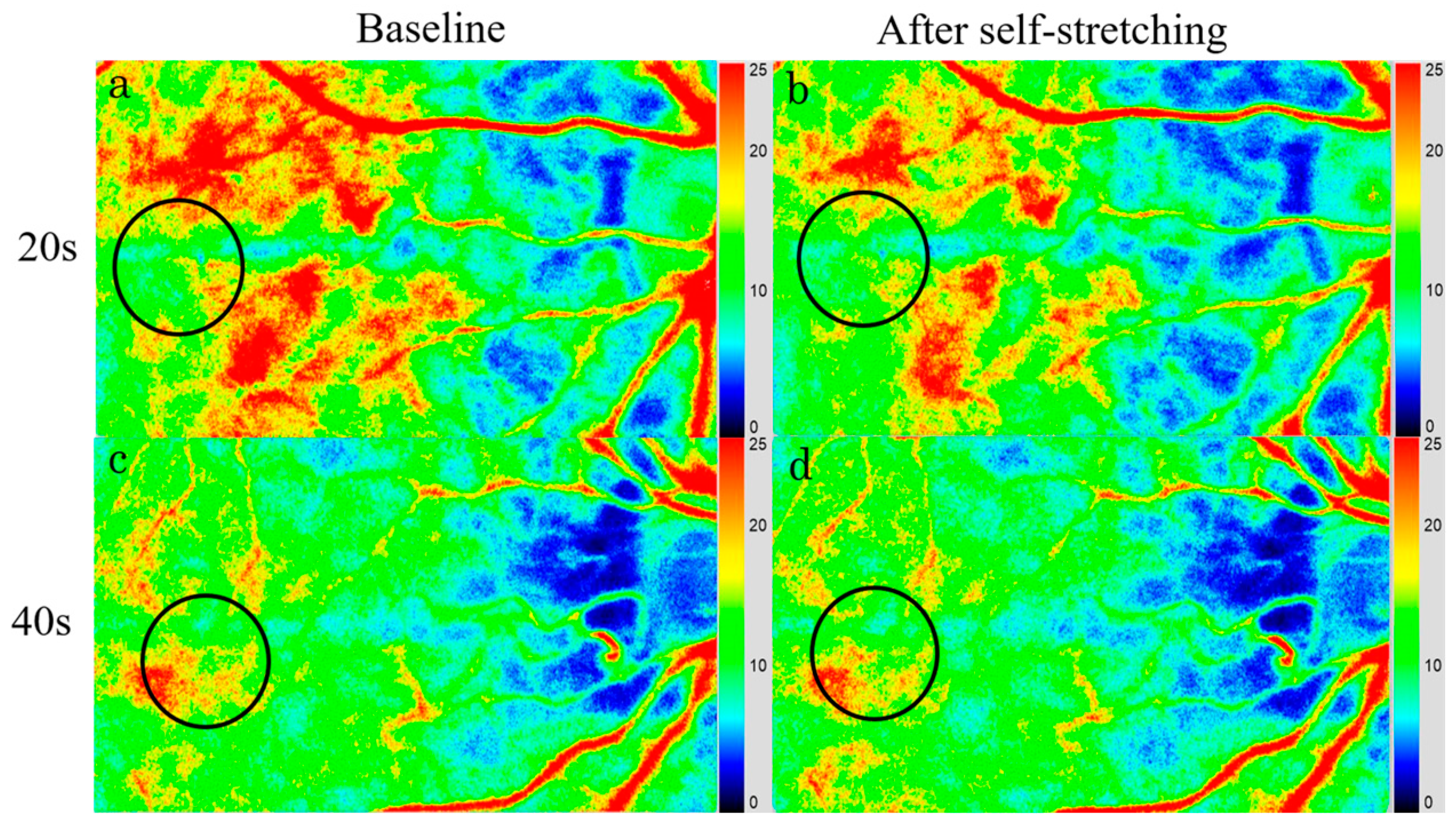 Tomography 11 00073 g004