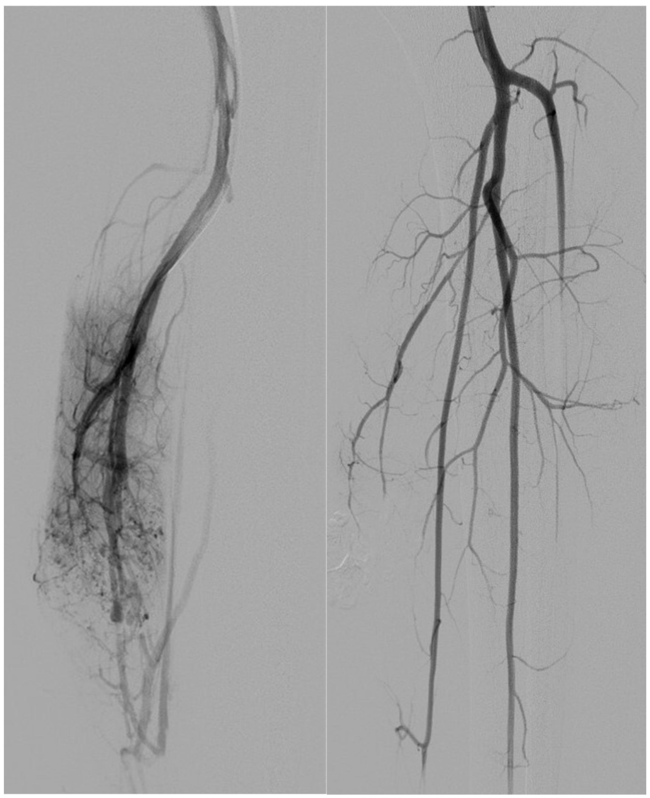 Tomography 11 00075 g001
