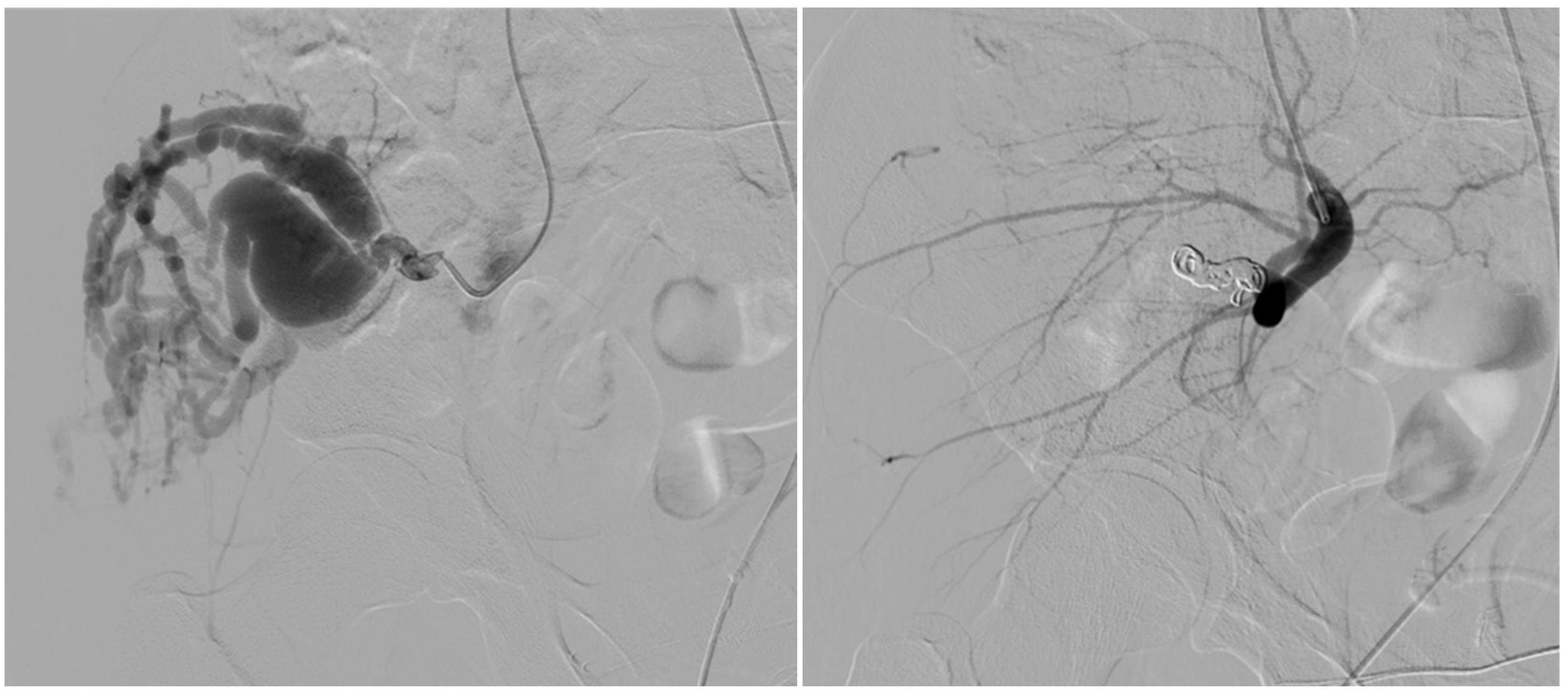 Tomography 11 00075 g002