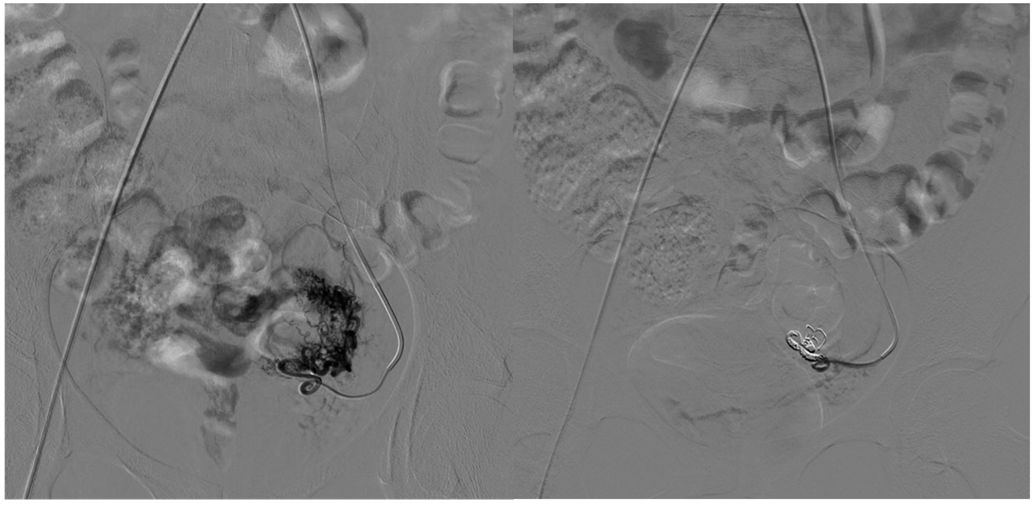 Tomography 11 00075 g003