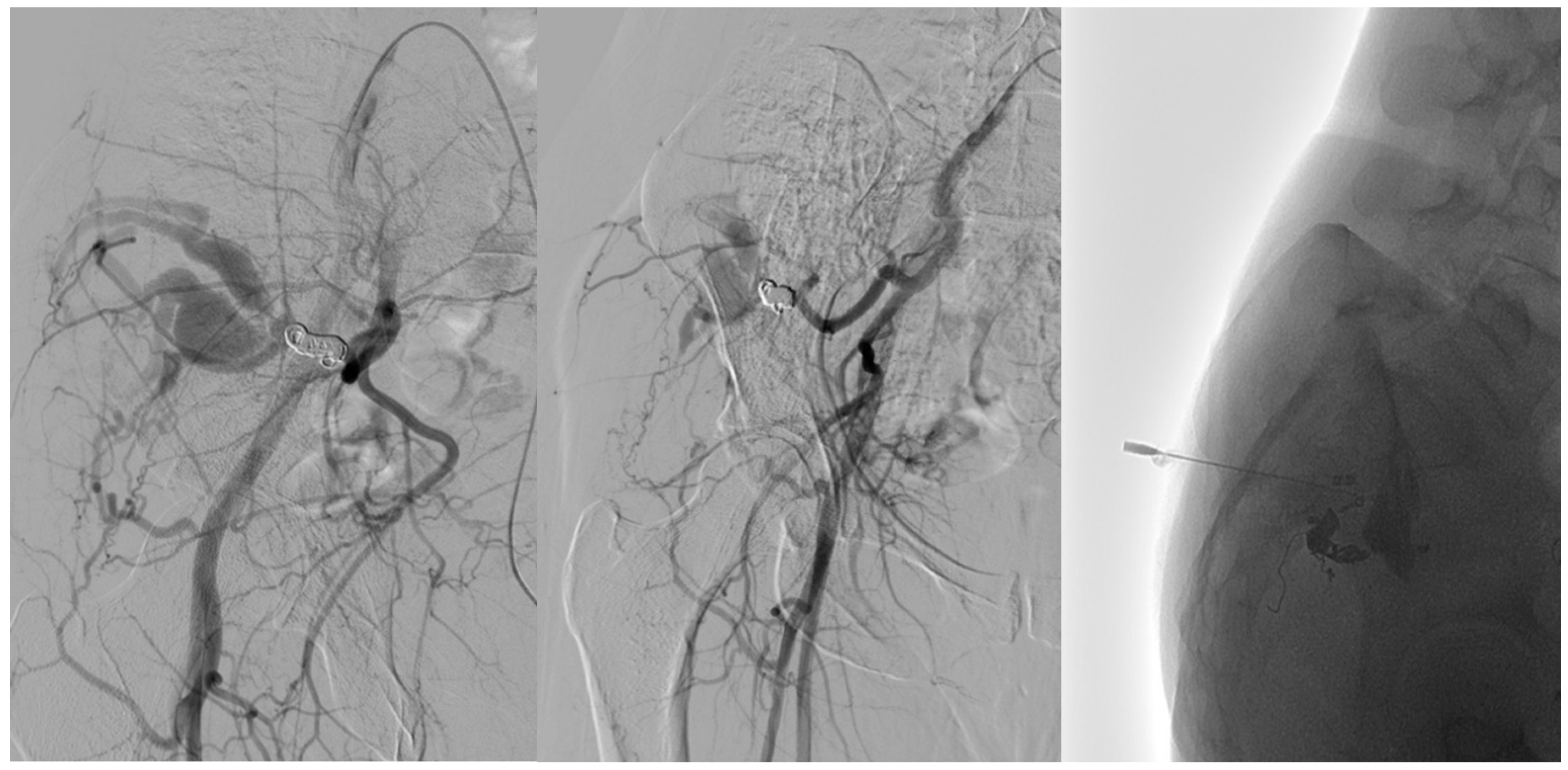 Tomography 11 00075 g004
