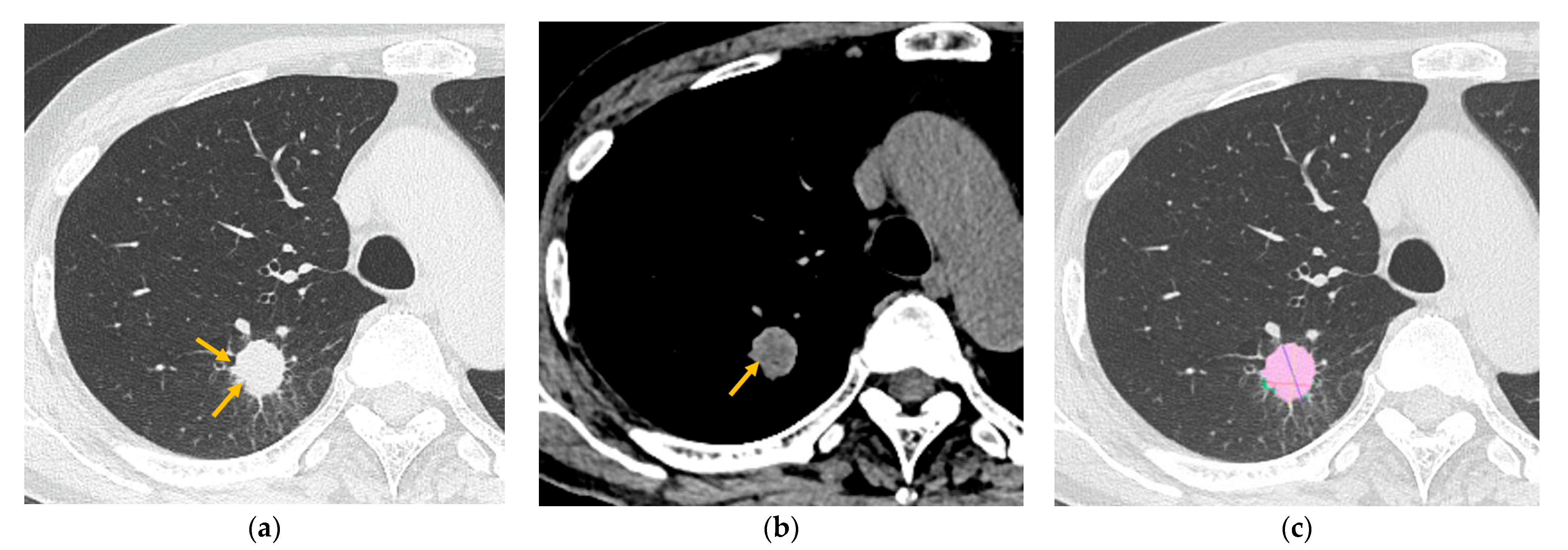 Tomography 11 00076 g003