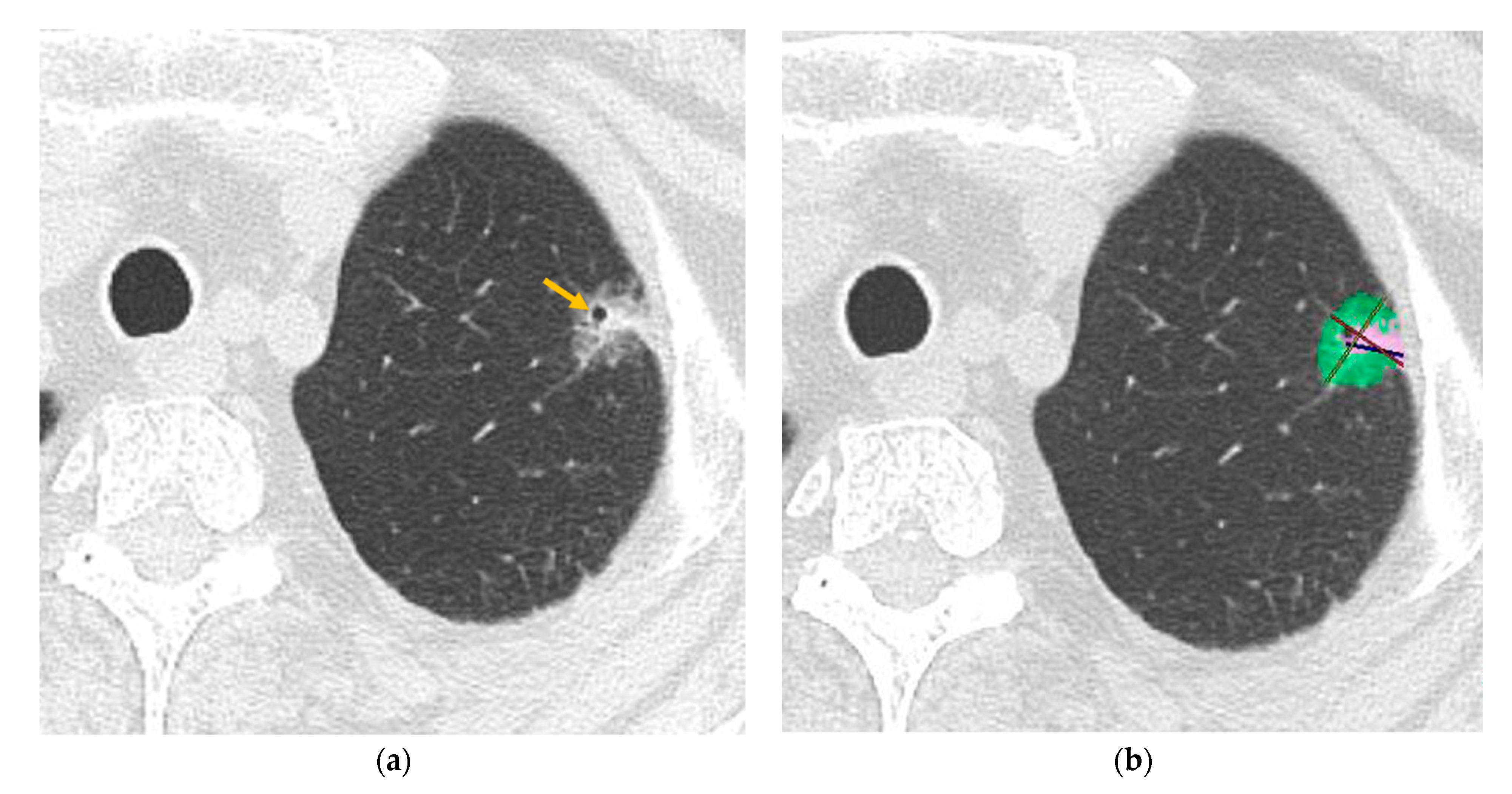 Tomography 11 00076 g004