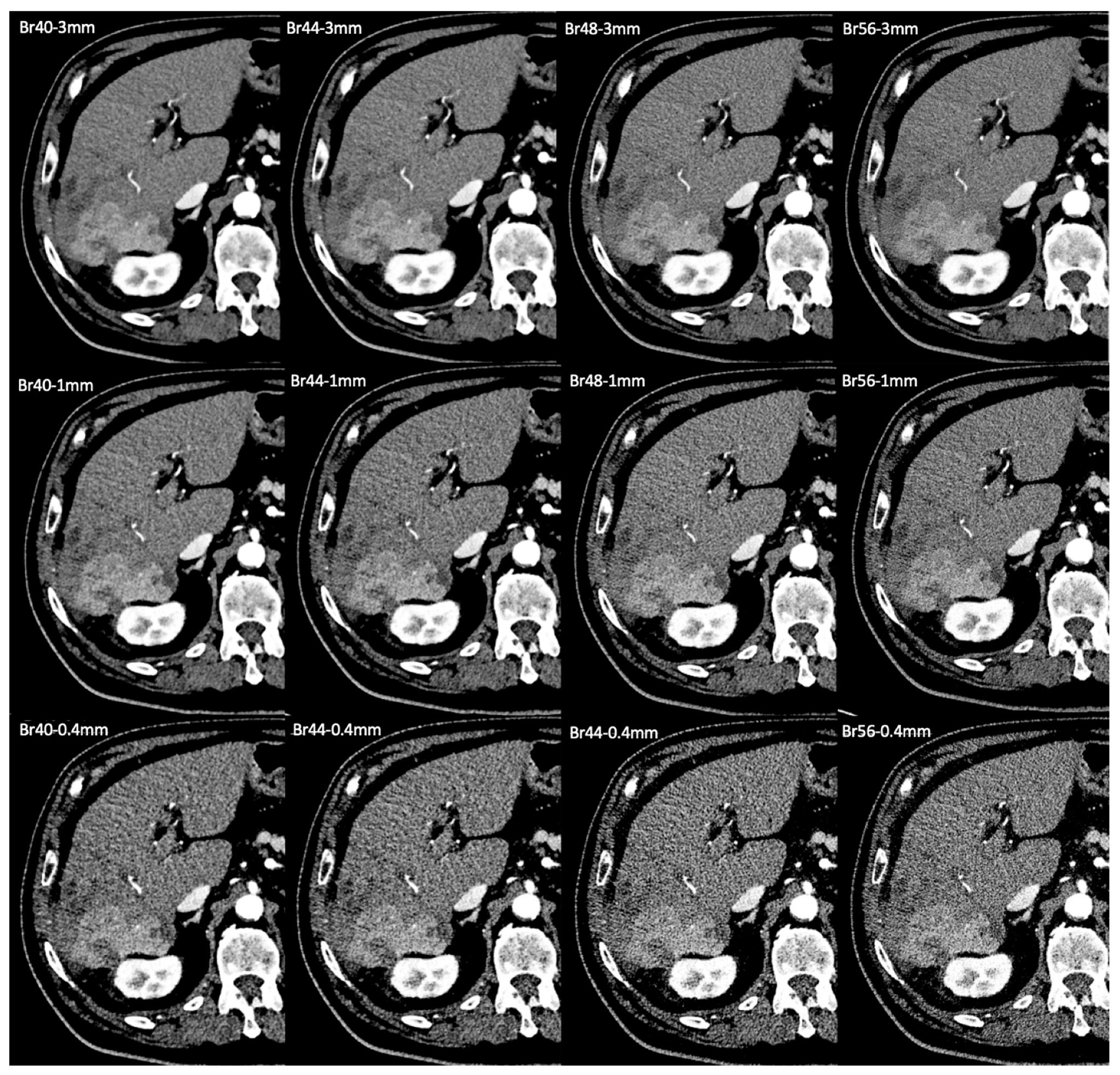 Tomography 11 00077 g005