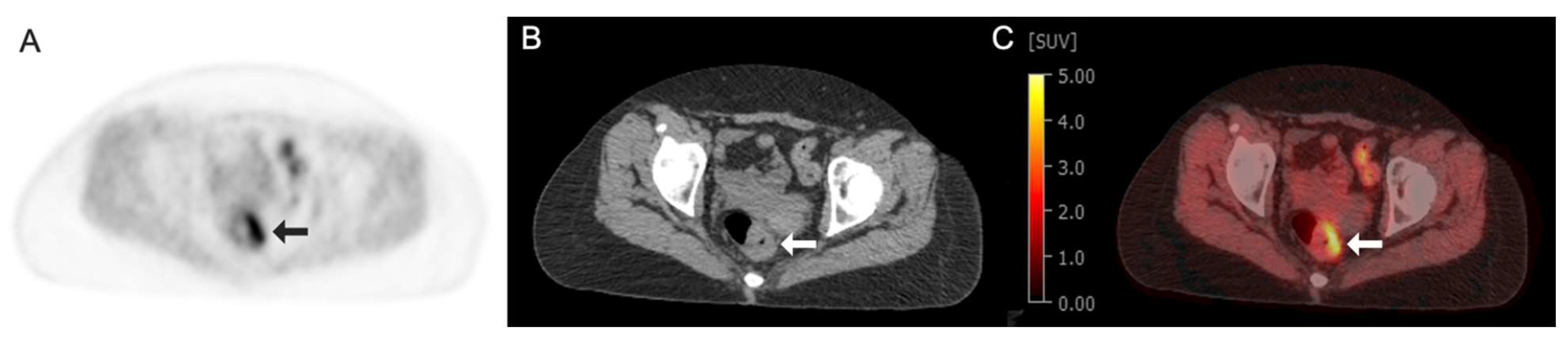Tomography 11 00083 g003 Tomography 11 00083 g003