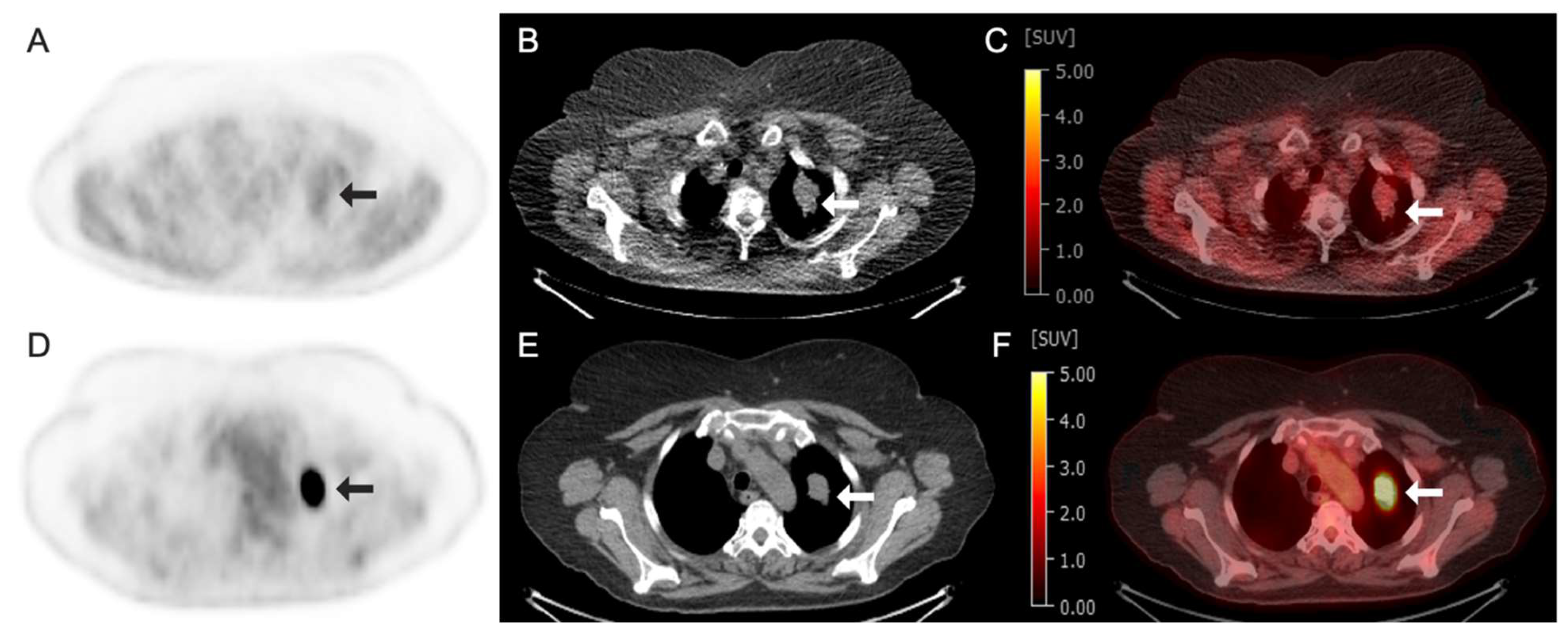 Tomography 11 00083 g004 Tomography 11 00083 g004