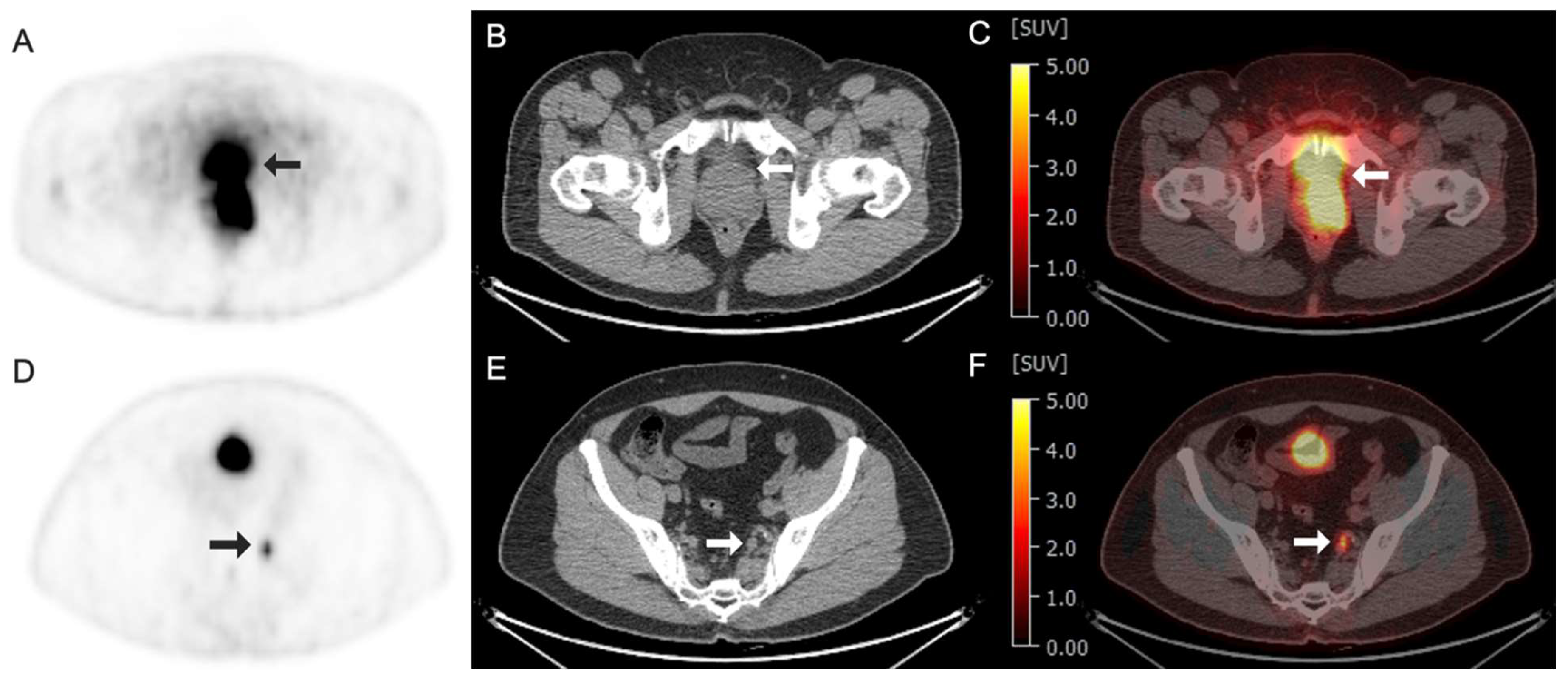 Tomography 11 00083 g005 Tomography 11 00083 g005