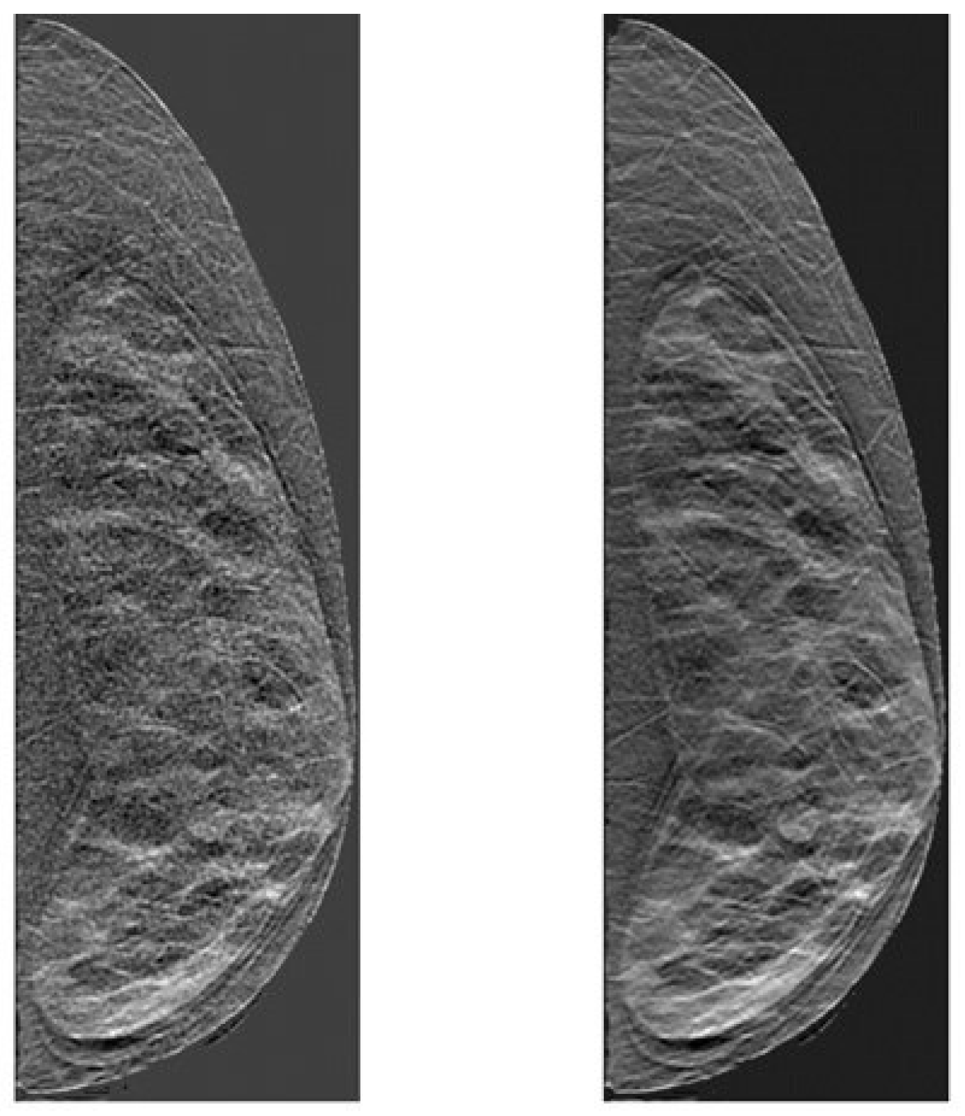 Tomography 11 00087 g002