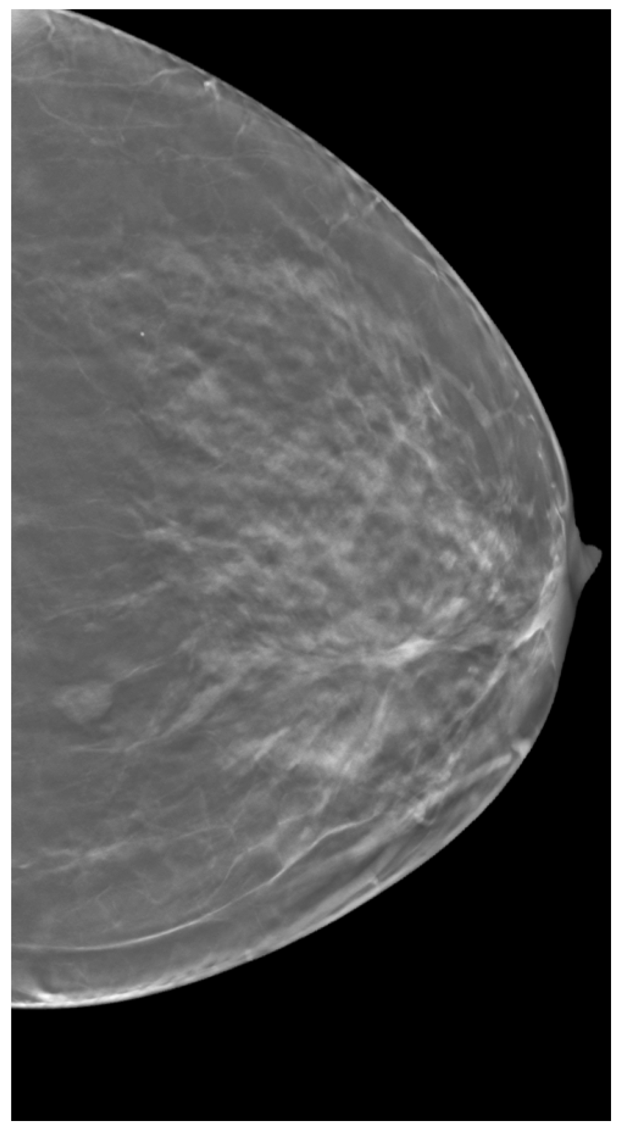 Tomography 11 00087 g003