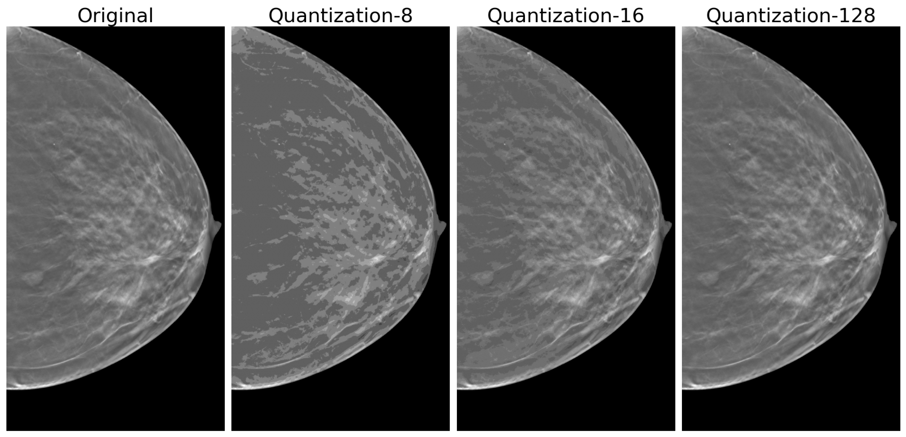 Tomography 11 00087 g004