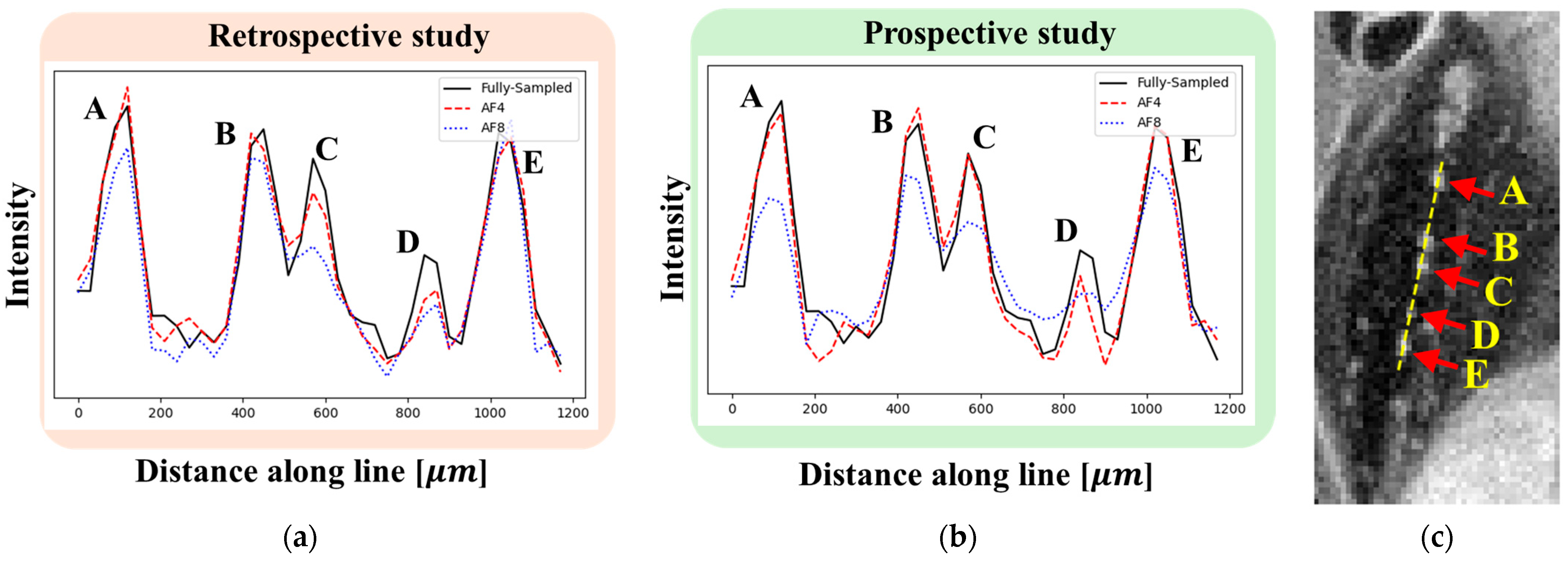 Tomography 11 00088 g010
