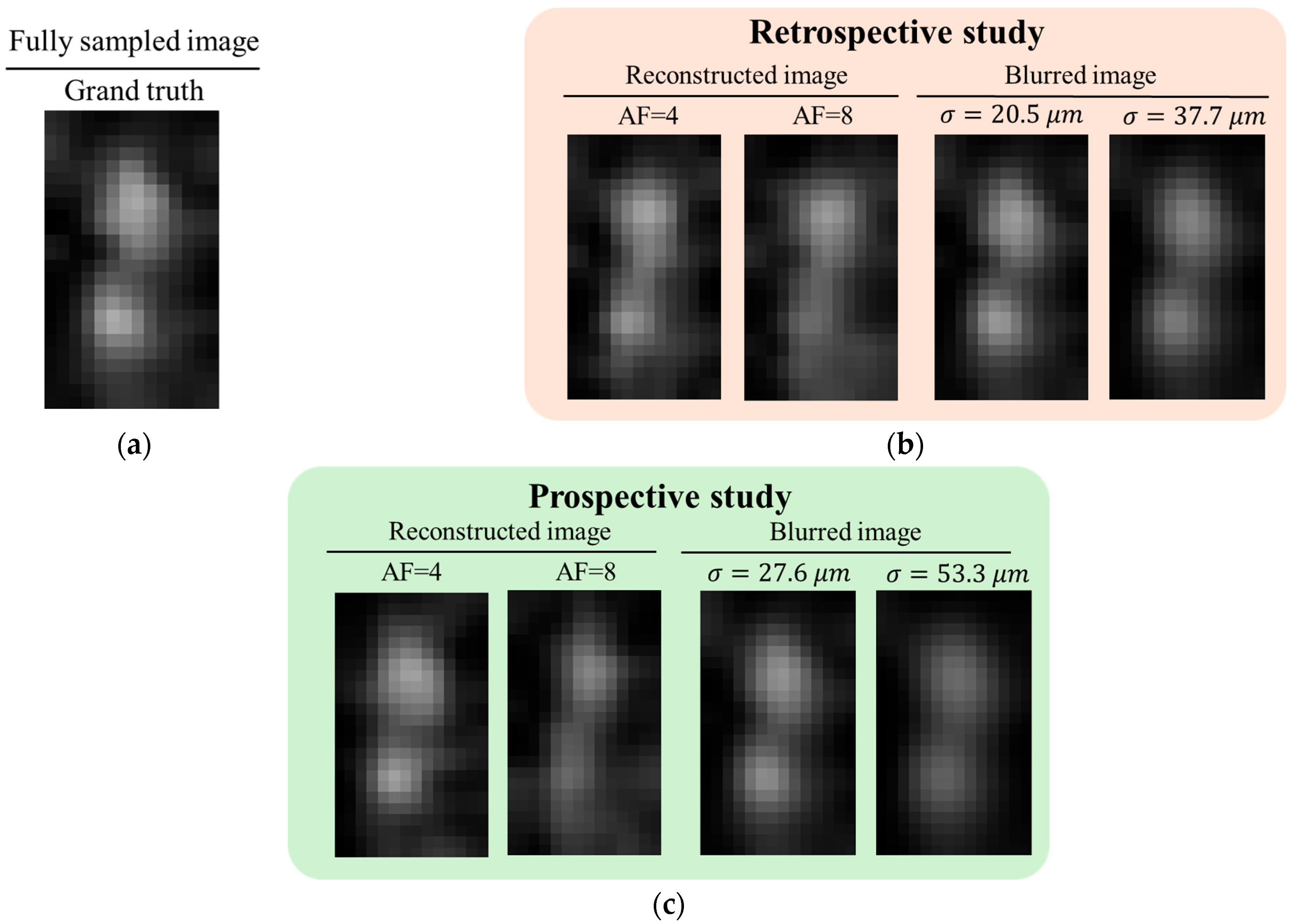 Tomography 11 00088 g011