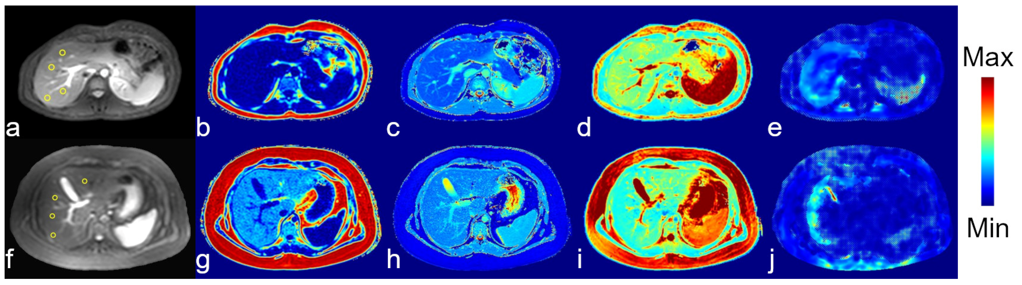 Tomography 11 00089 g003 Tomography 11 00089 g003