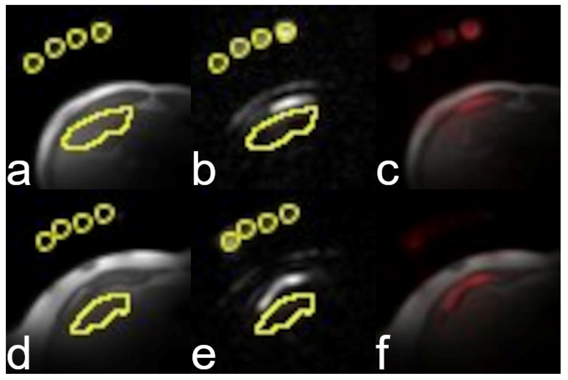 Tomography 11 00089 g005 Tomography 11 00089 g005
