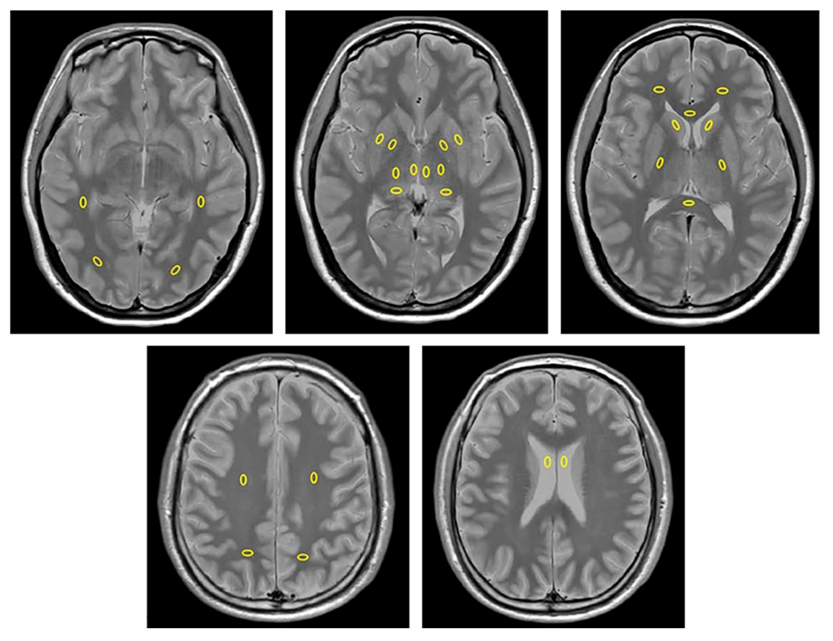 Tomography 11 00095 g001 Tomography 11 00095 g001
