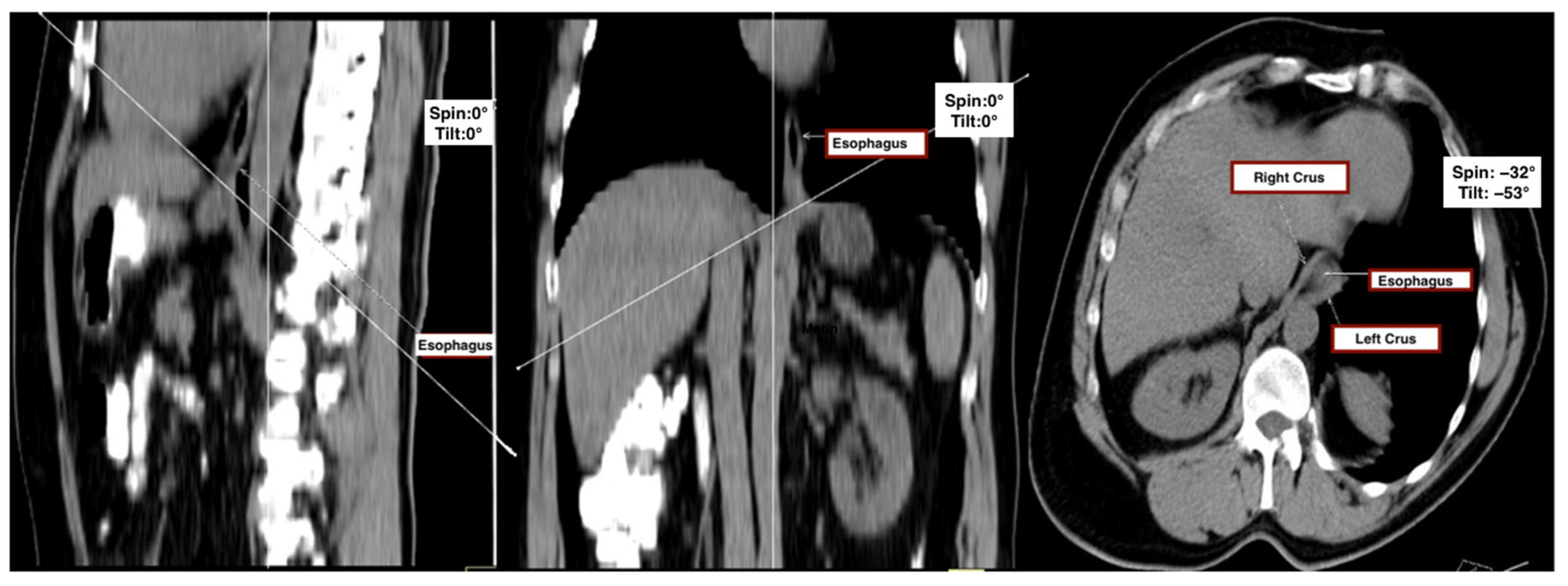 Tomography 11 00098 g001