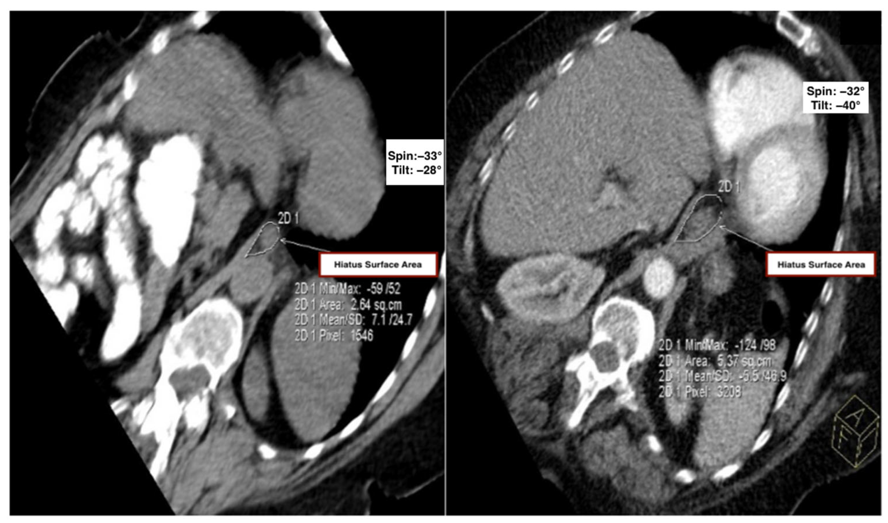 Tomography 11 00098 g002