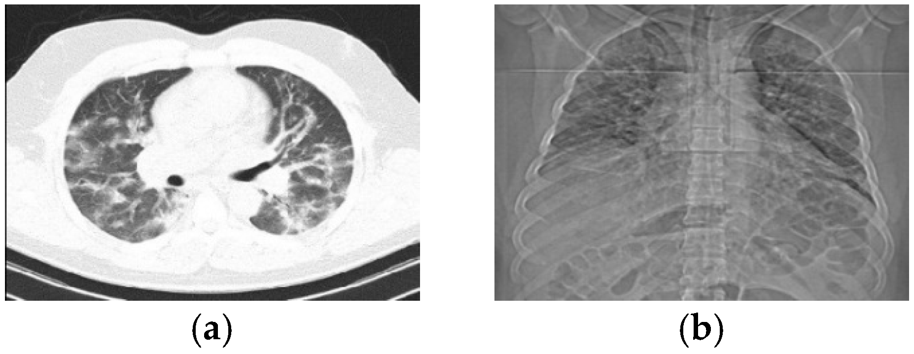 Tomography 11 00099 g001