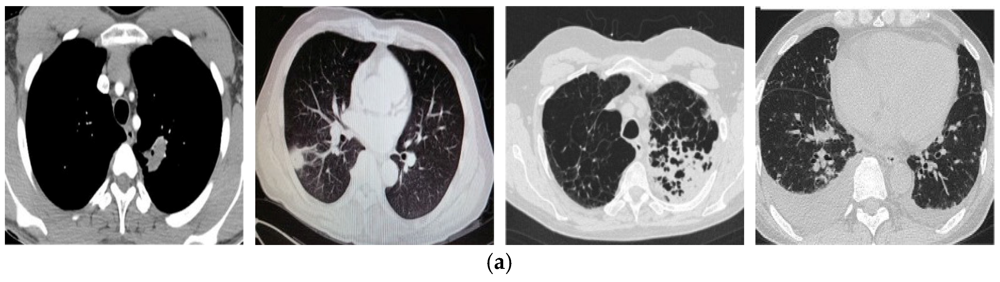 Tomography 11 00099 g006a