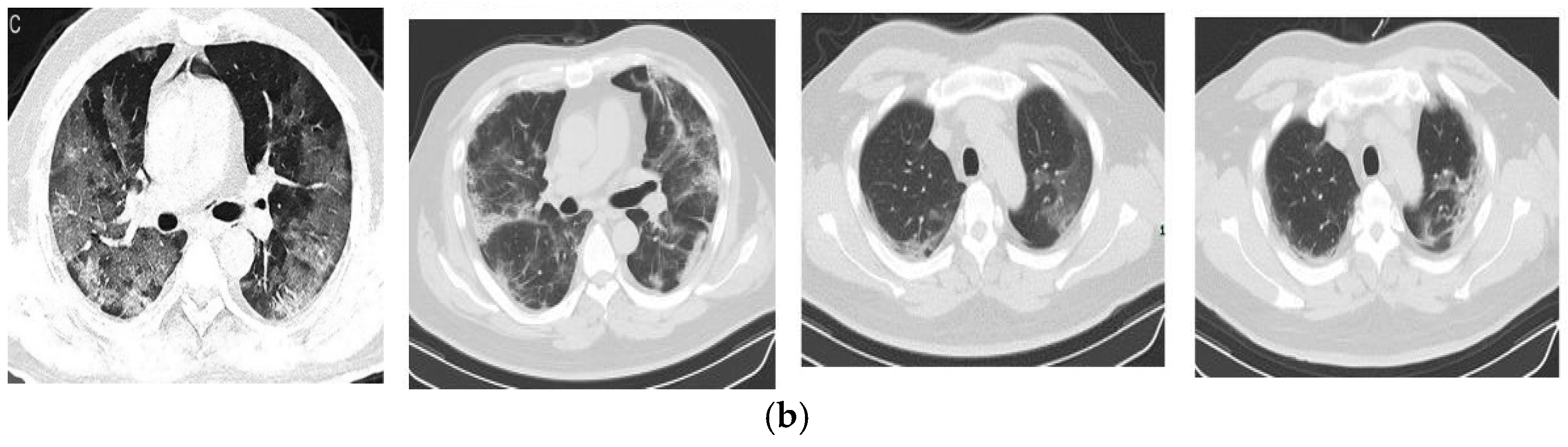 Tomography 11 00099 g006b