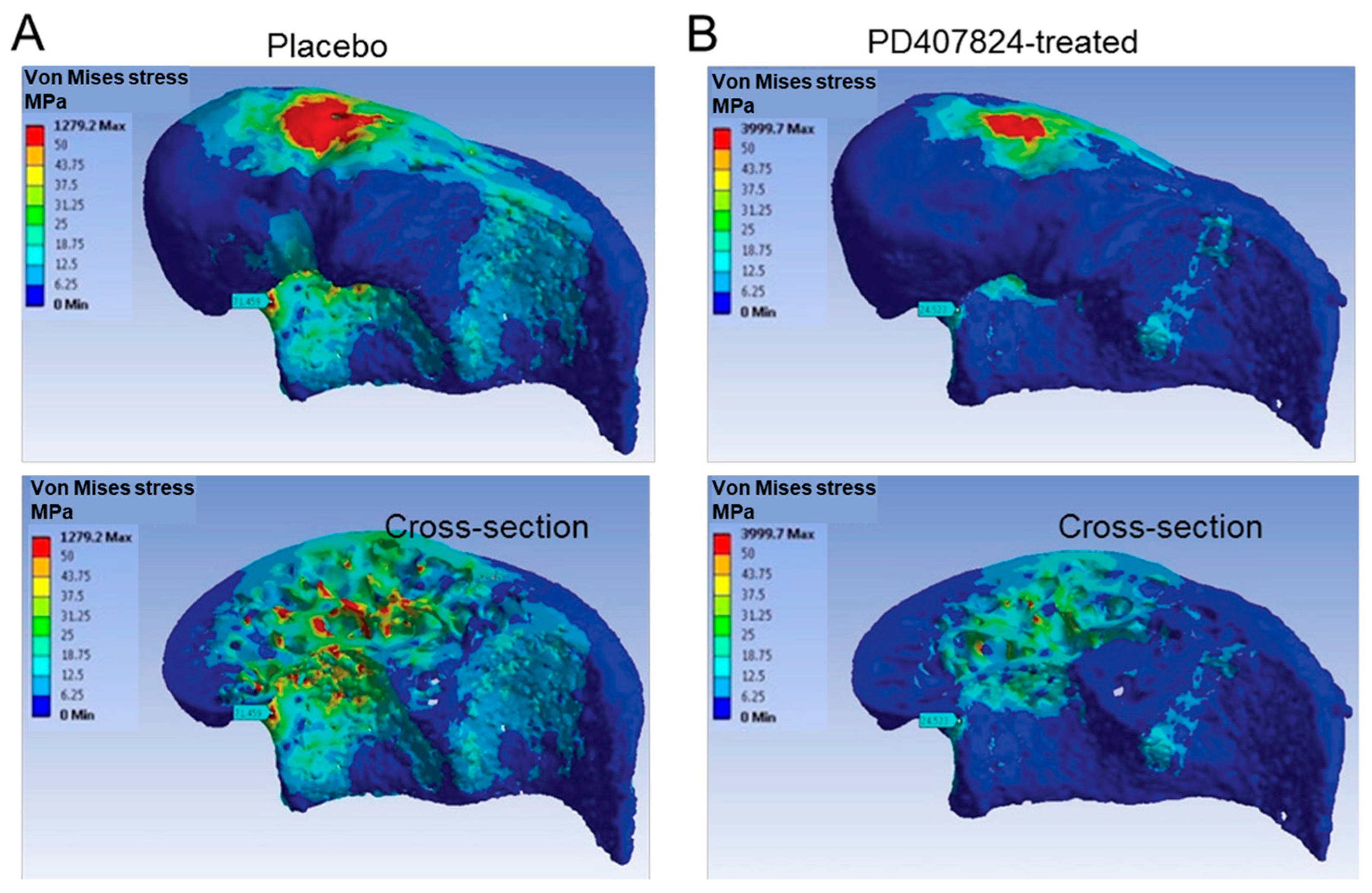 Tomography 11 00101 g003 Tomography 11 00101 g003