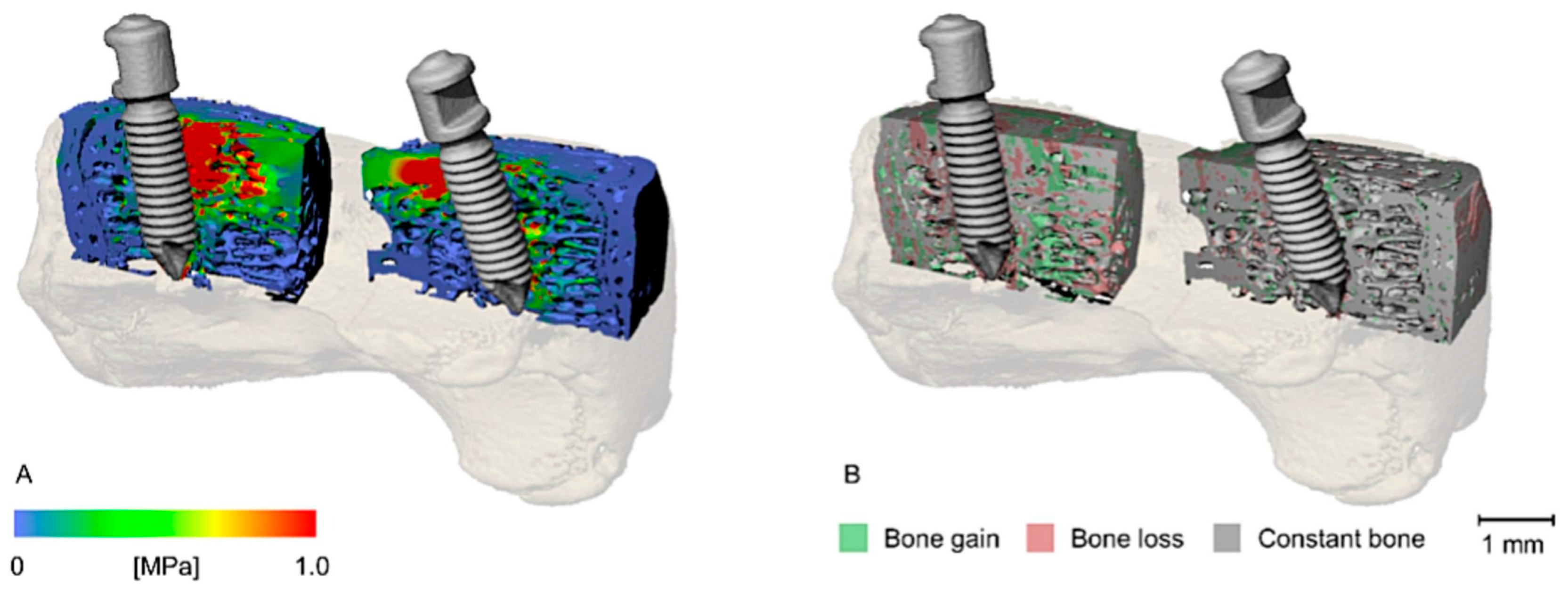 Tomography 11 00101 g004 Tomography 11 00101 g004