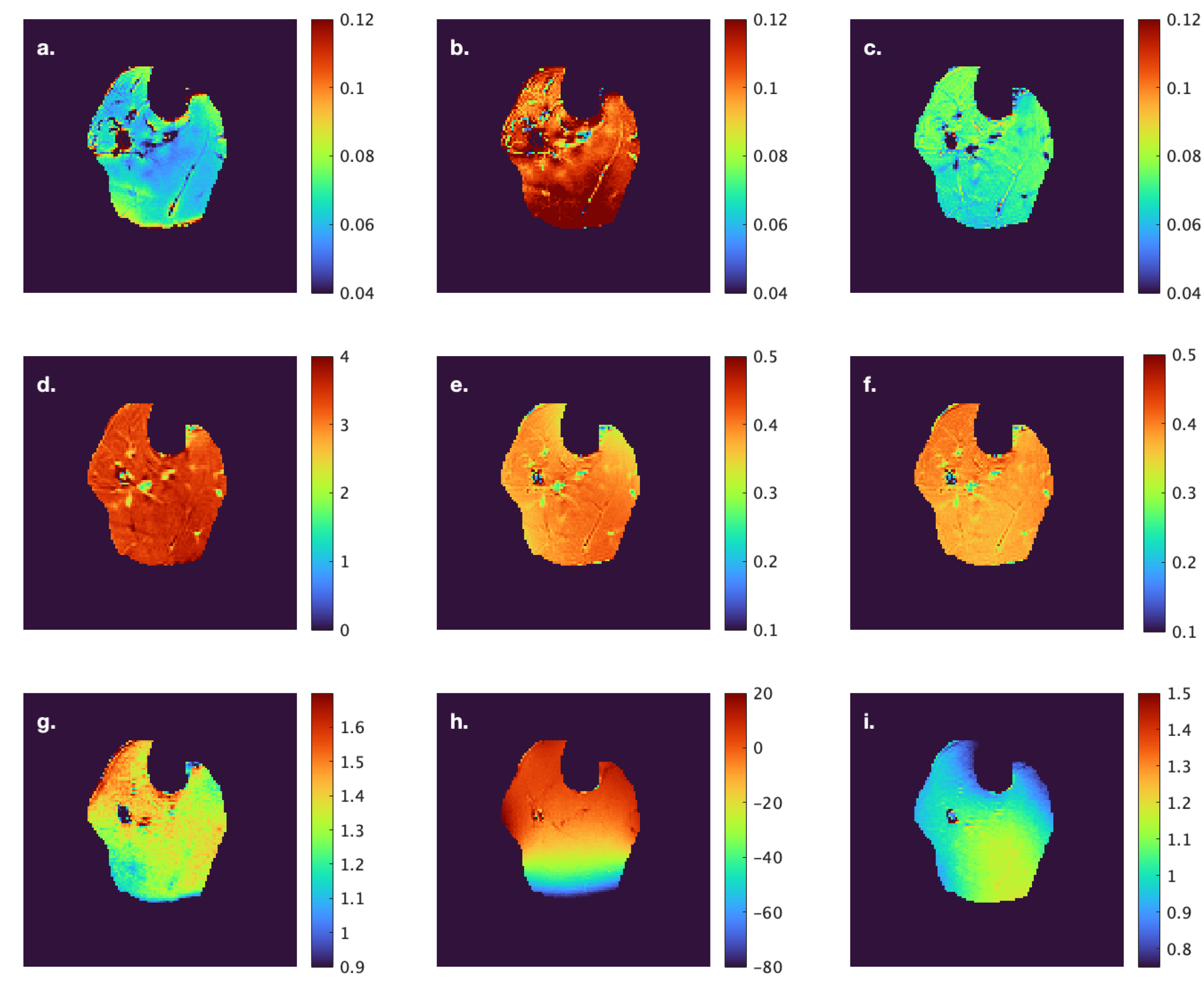 Tomography 11 00103 g003