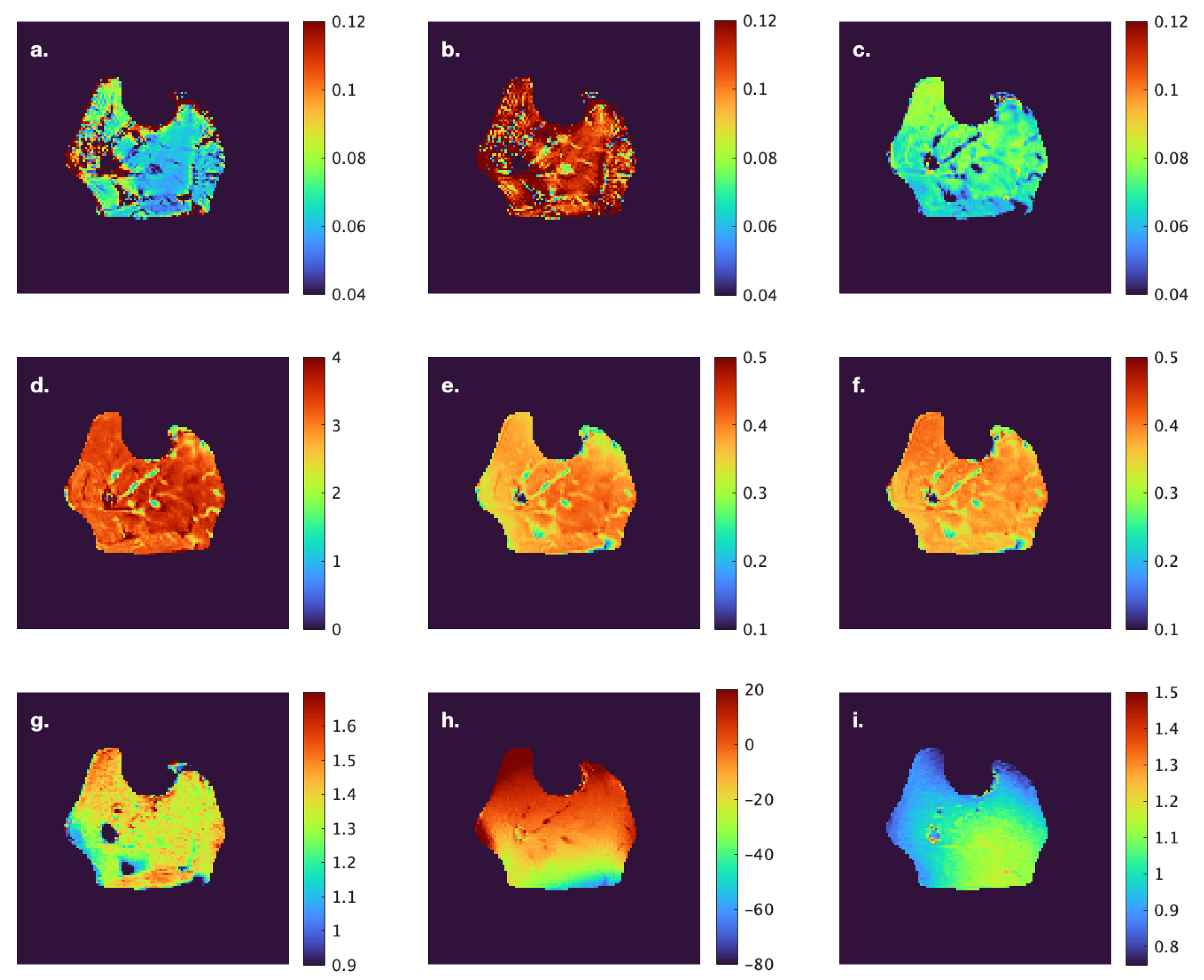 Tomography 11 00103 g004