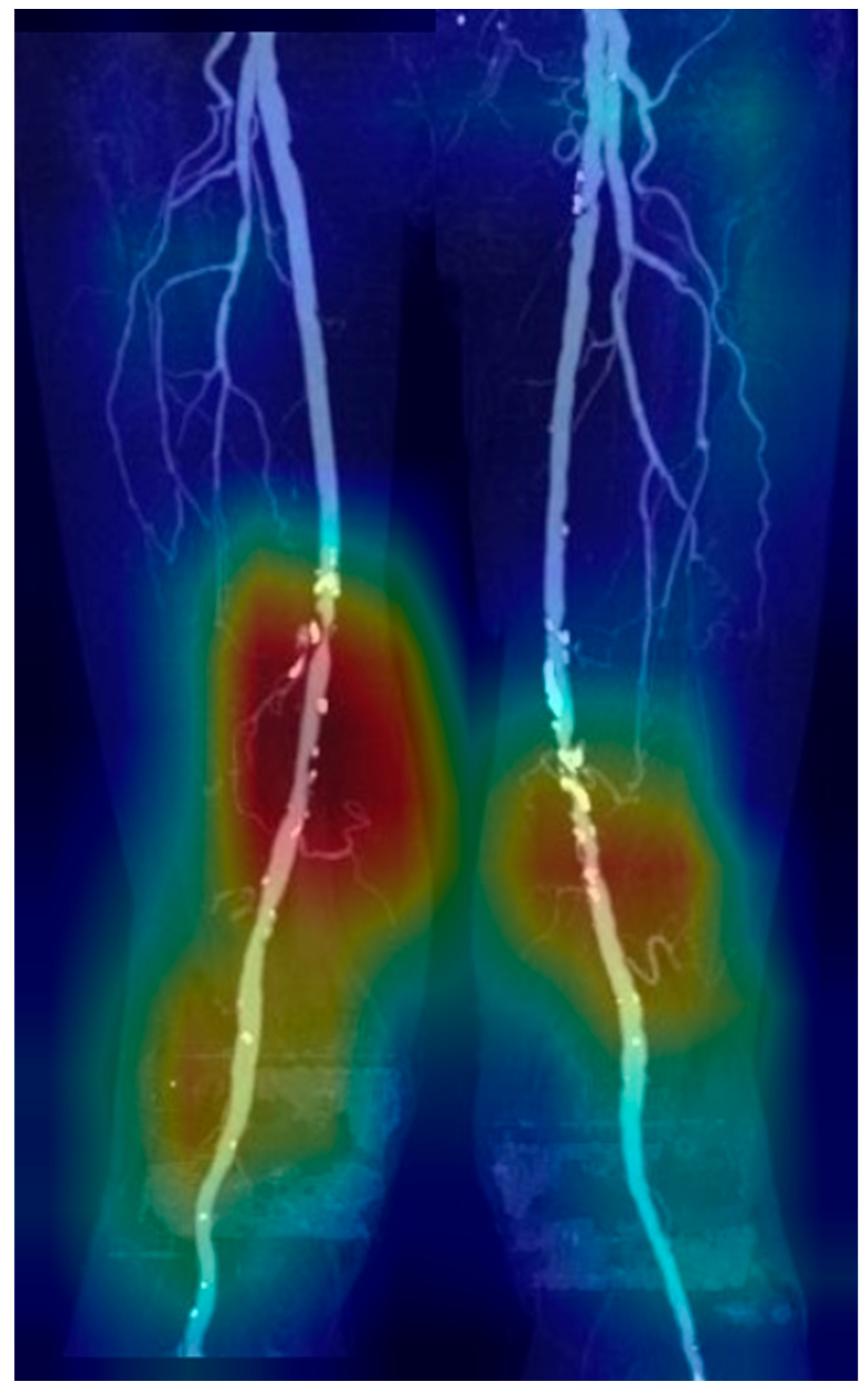 Tomography 11 00104 g003 Tomography 11 00104 g003