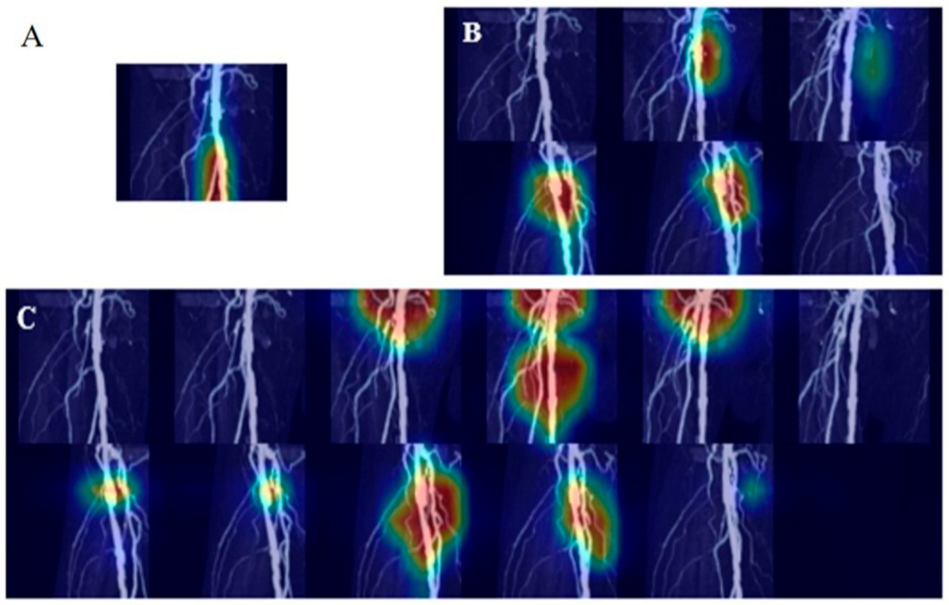 Tomography 11 00104 g005 Tomography 11 00104 g005
