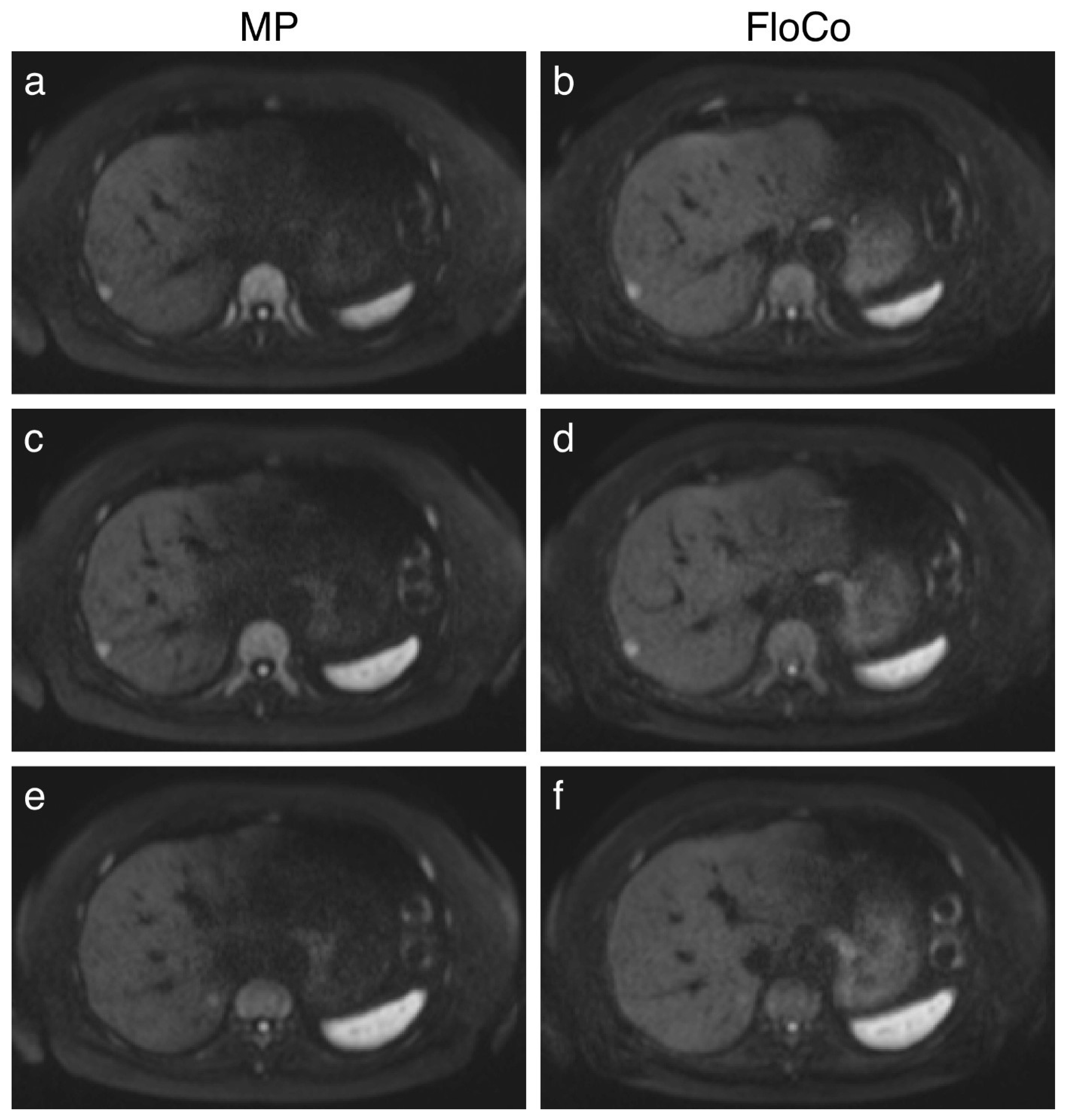 Tomography 11 00106 g001 Tomography 11 00106 g001
