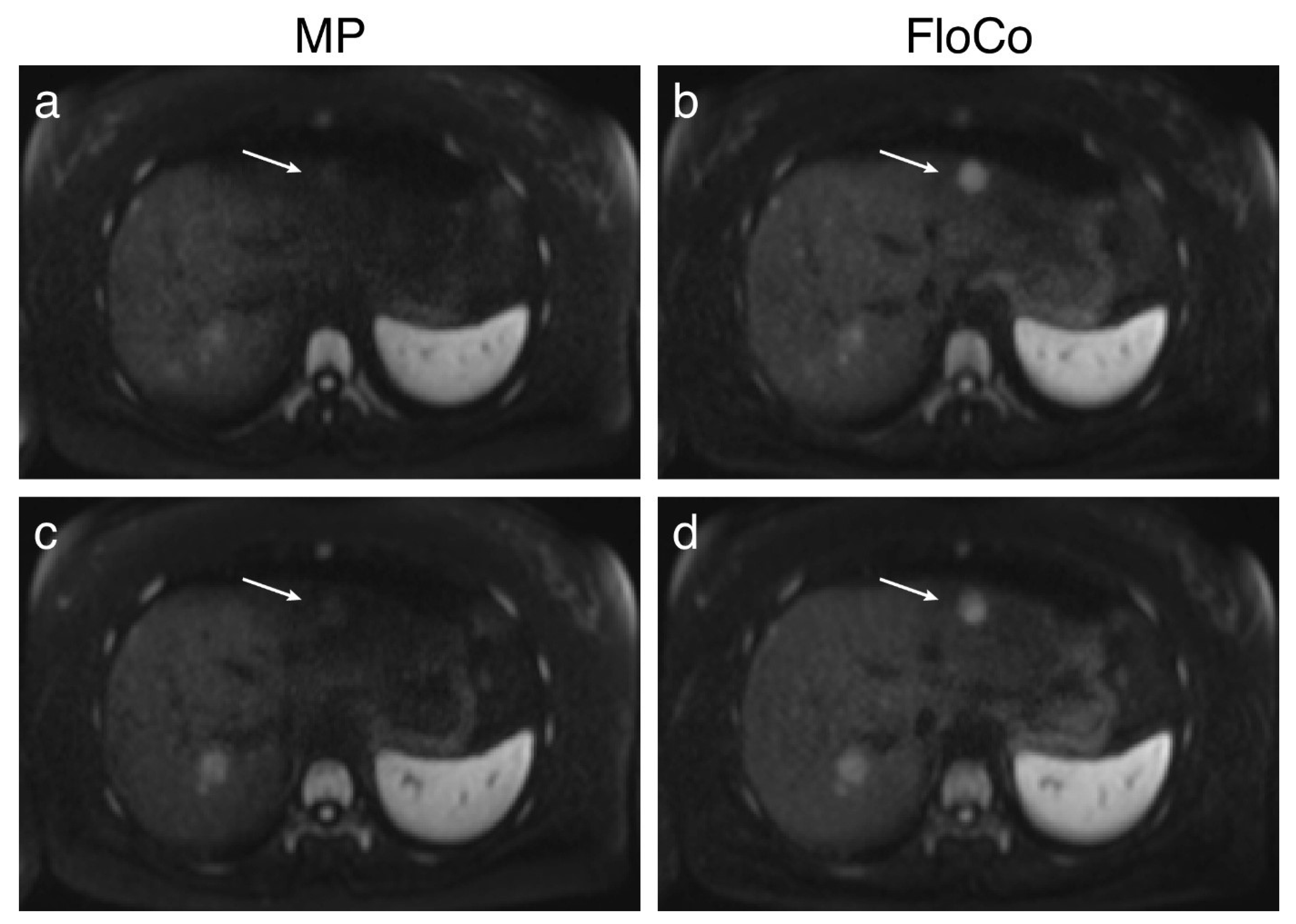 Tomography 11 00106 g002 Tomography 11 00106 g002