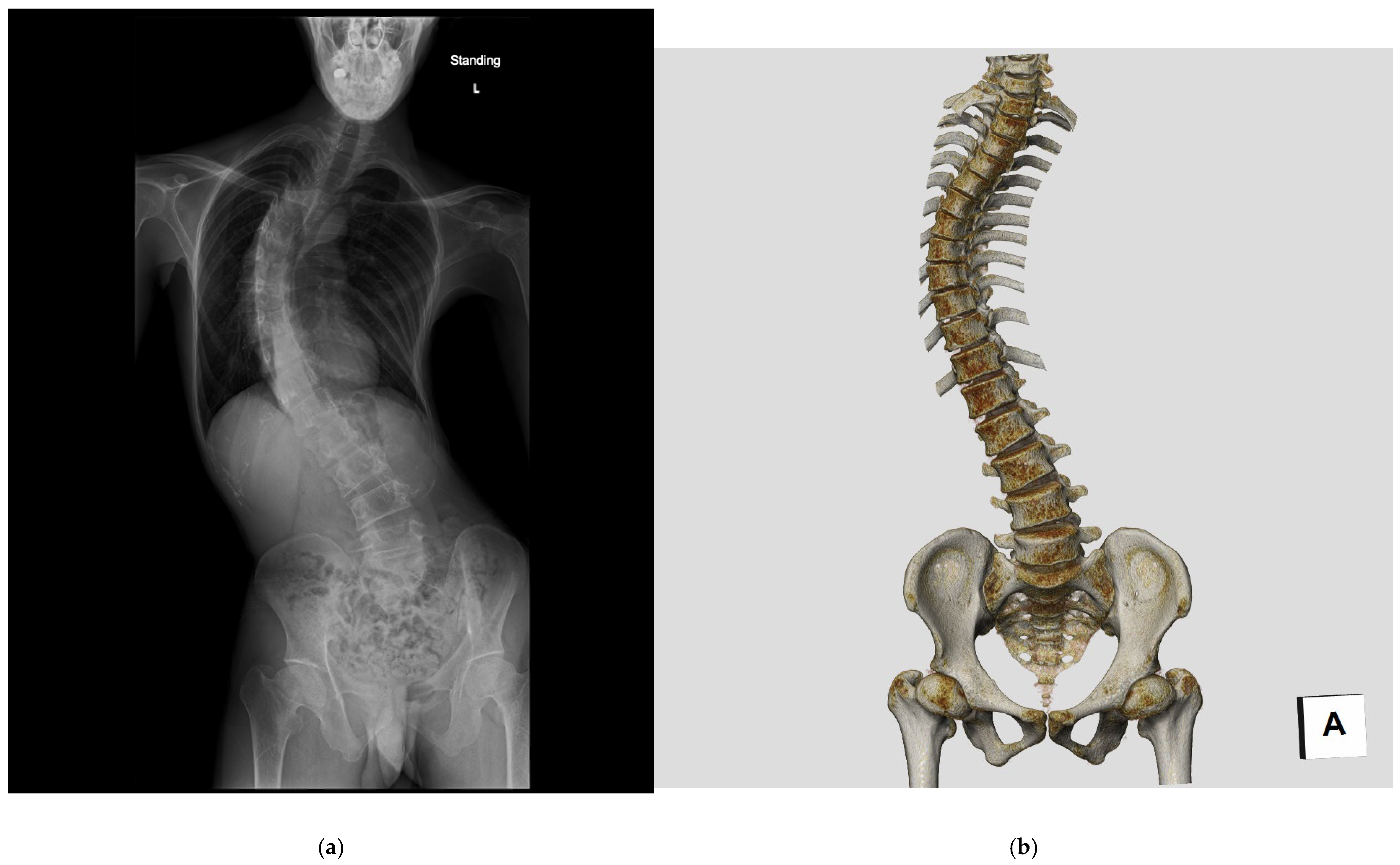 Tomography 11 00110 g001 Tomography 11 00110 g001