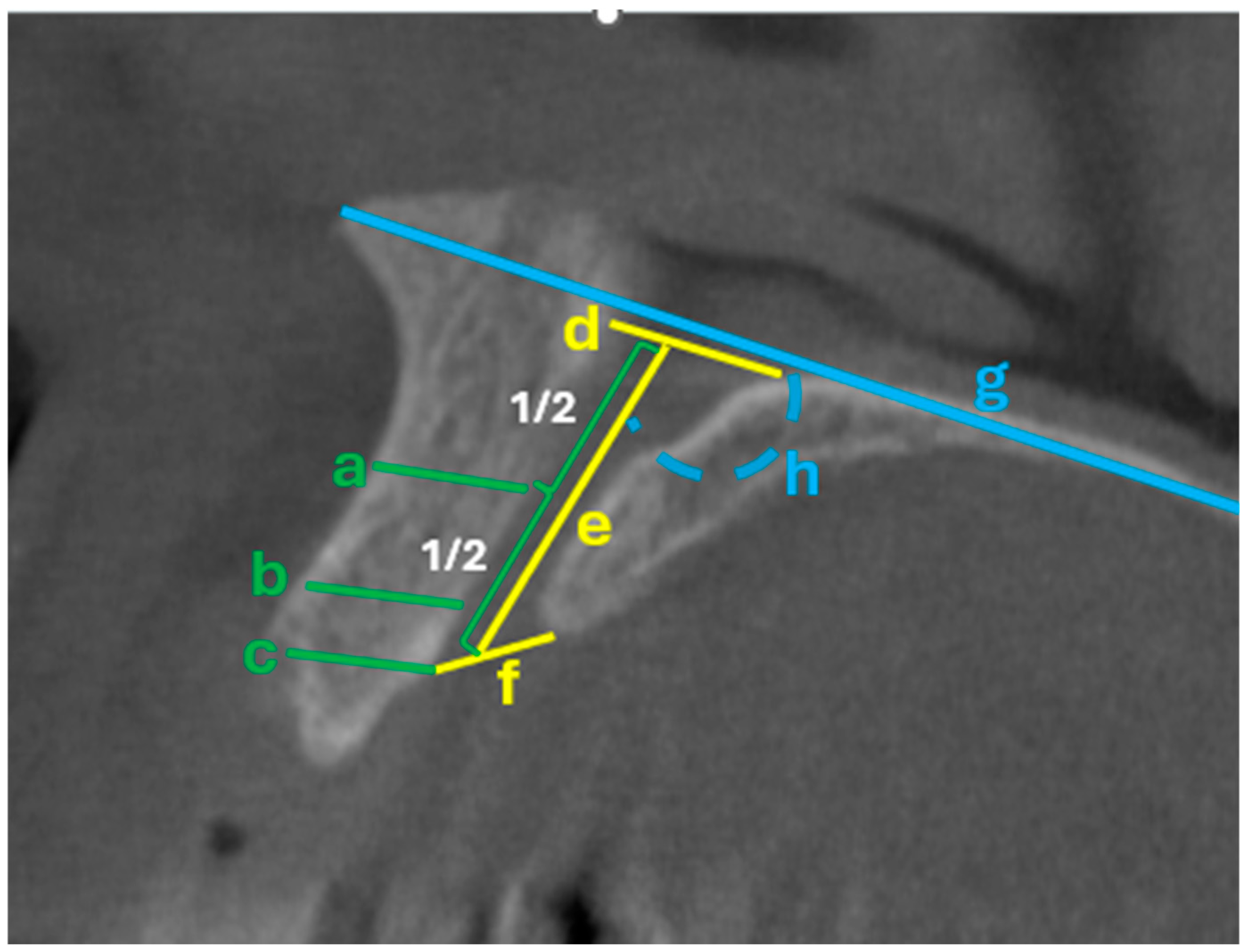 Tomography 11 00114 g003