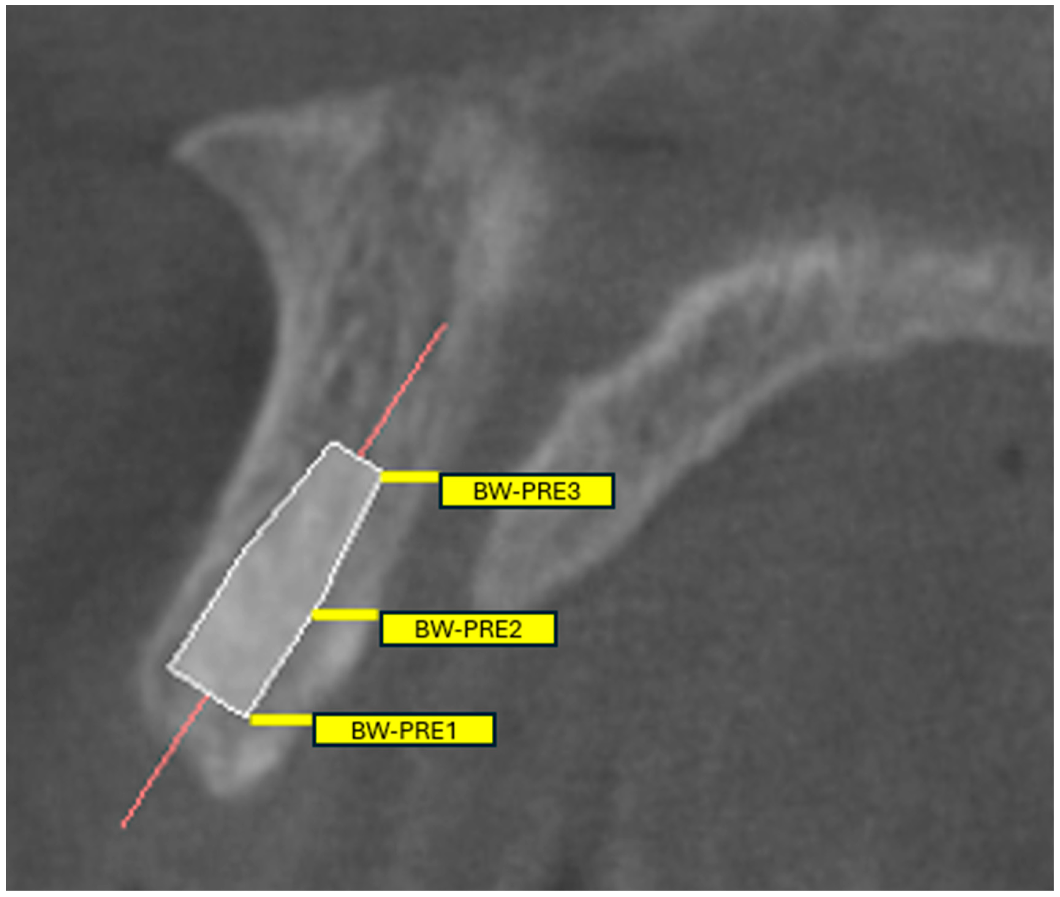 Tomography 11 00114 g004