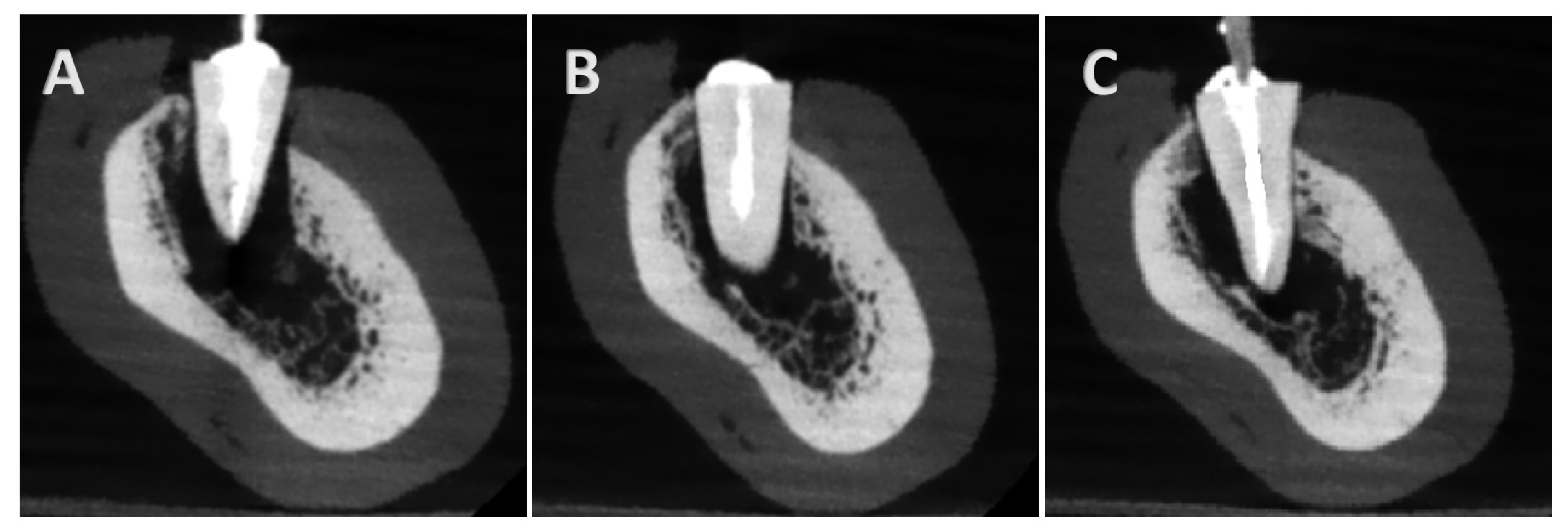 Tomography 11 00116 g004