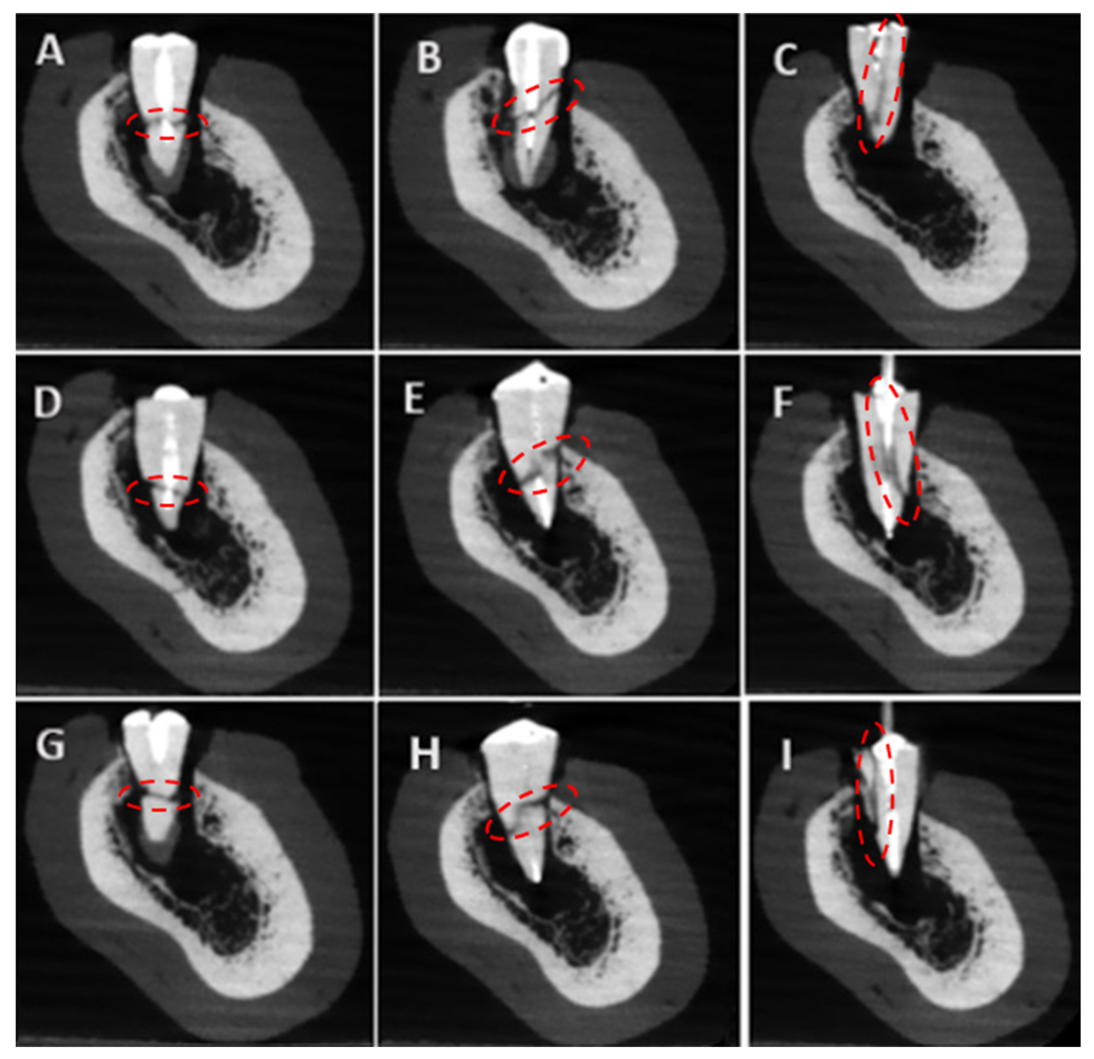 Tomography 11 00116 g005