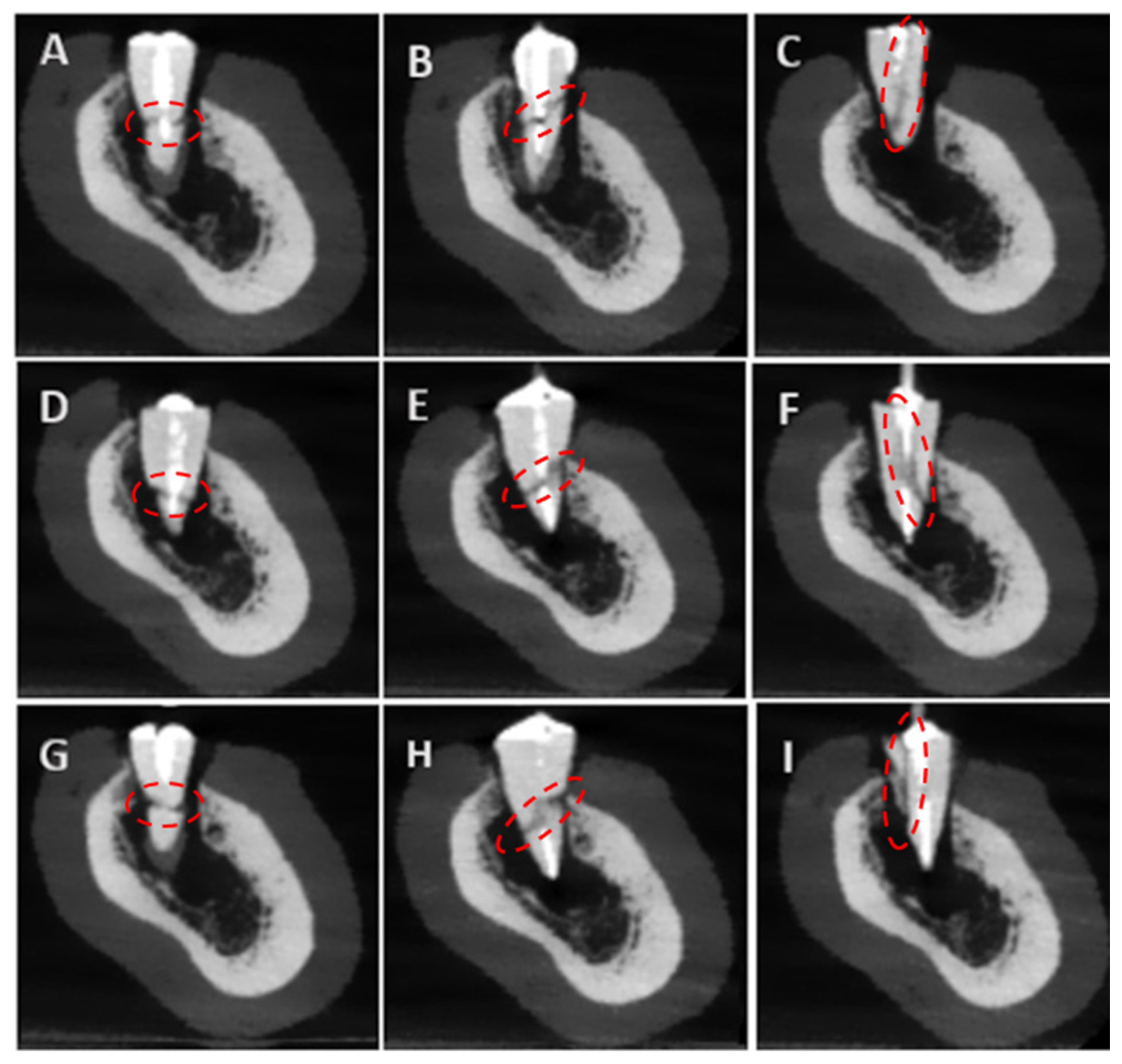 Tomography 11 00116 g006